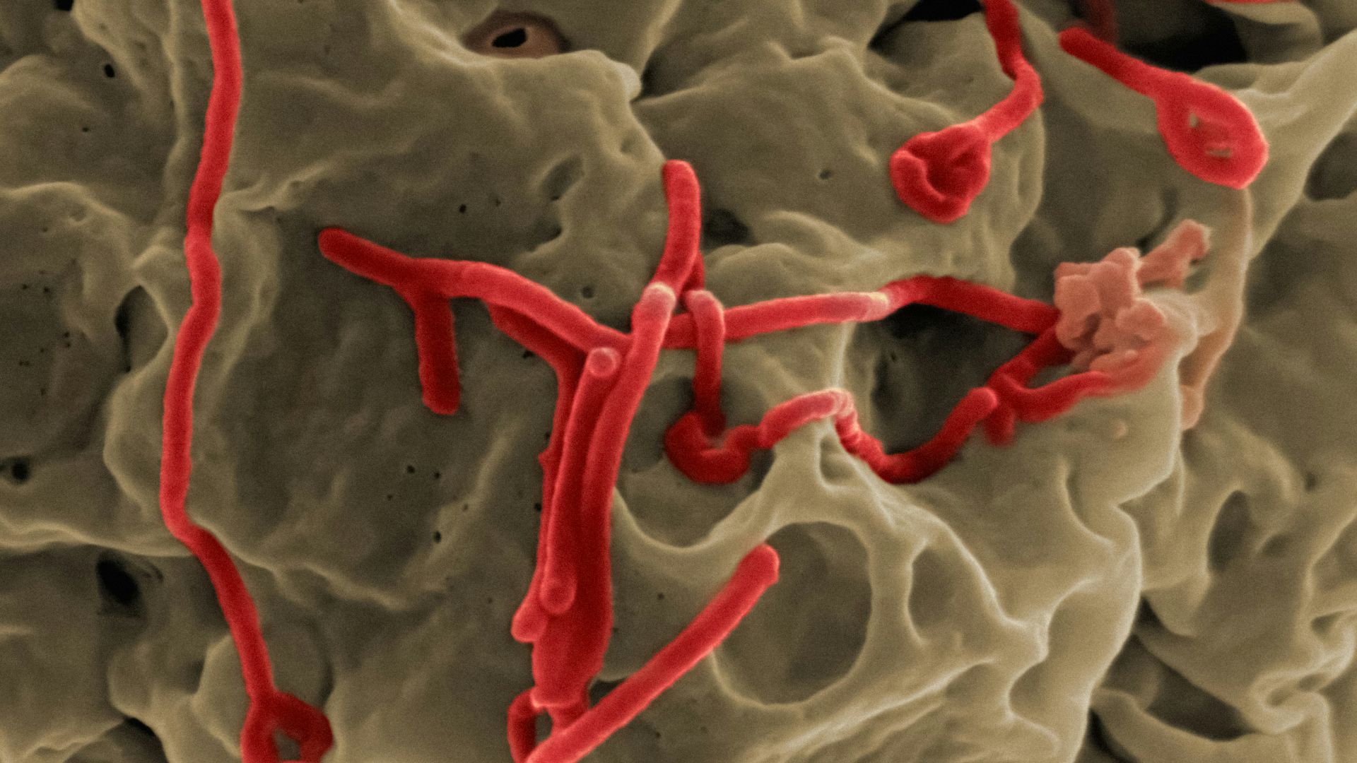 a blood vessel with red blood flowing out of it