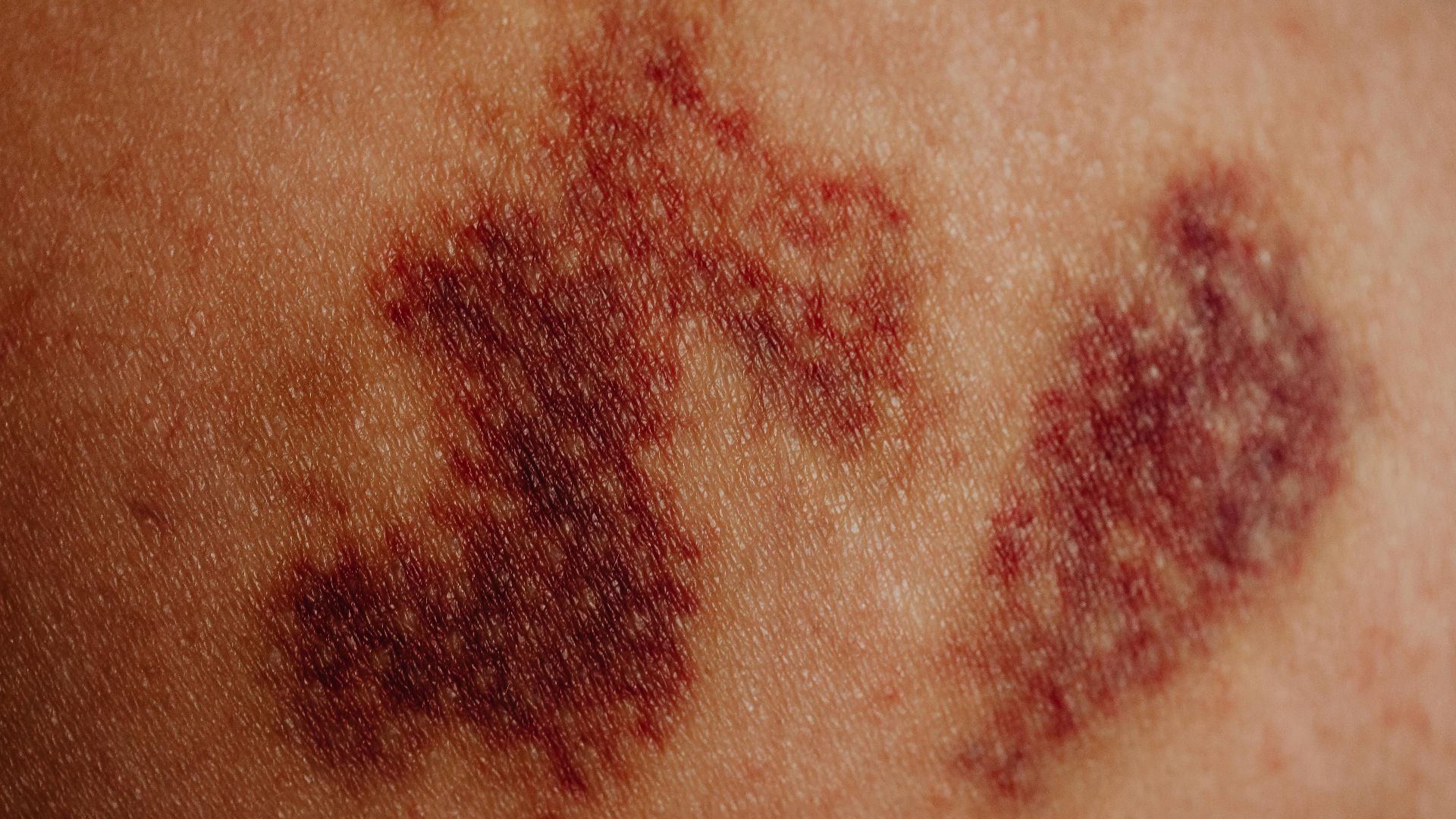 Photo By: Kaboompics.com