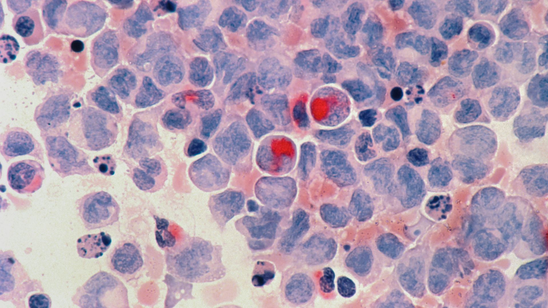 red round fruits on white and blue surface