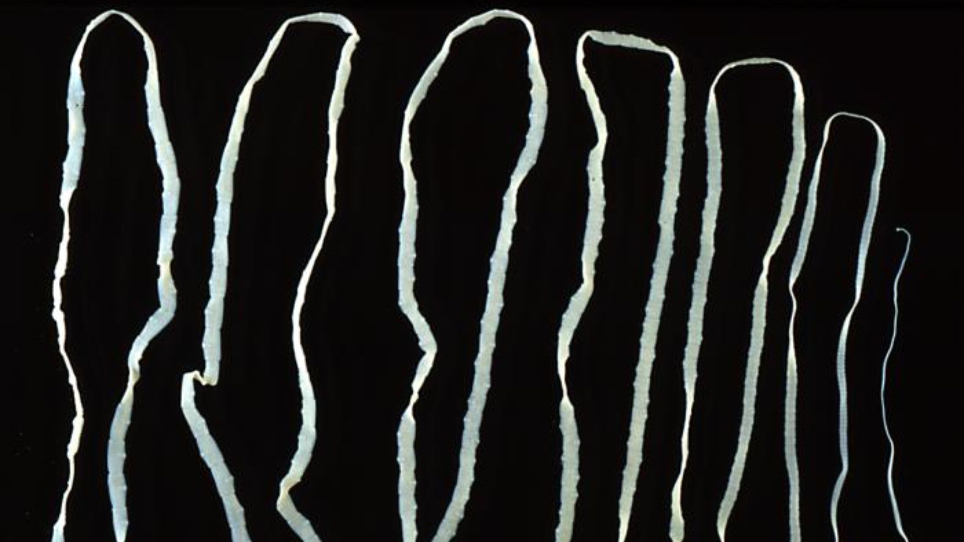 File:Taenia saginata adult 5260 lores.jpg