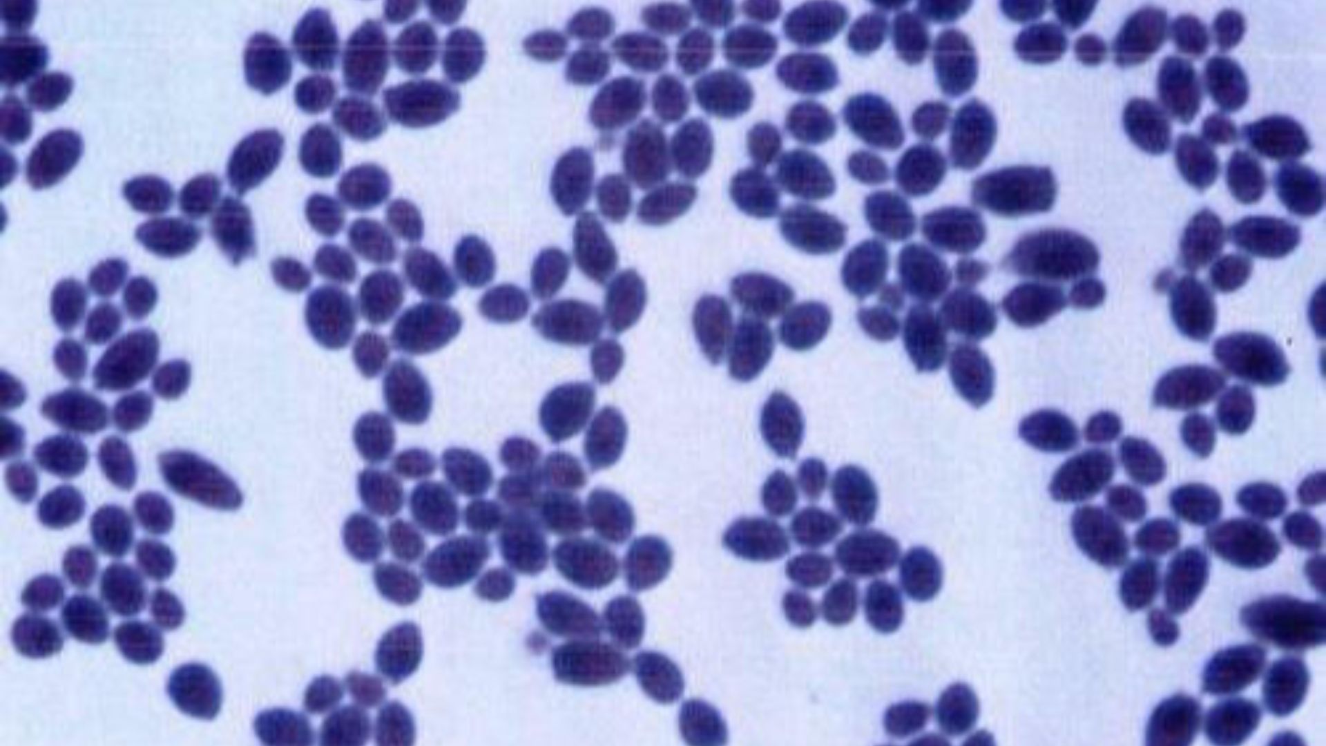 File:Saccharomyces boulardii.jpg