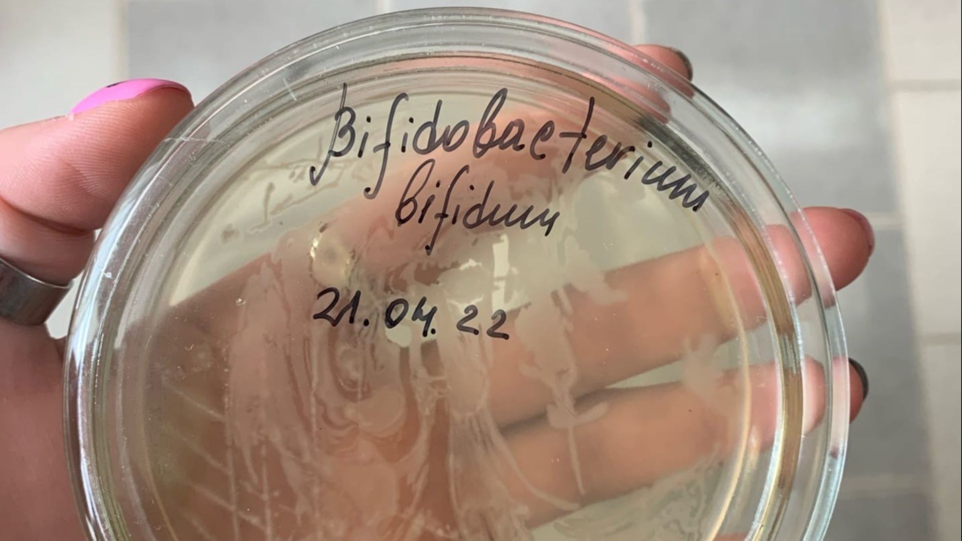 File:Bifidobacterium bifidum, рост в чашках.jpg