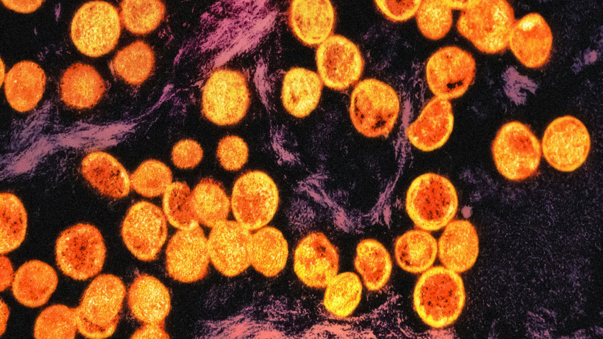 a bunch of orange lights that are on a table