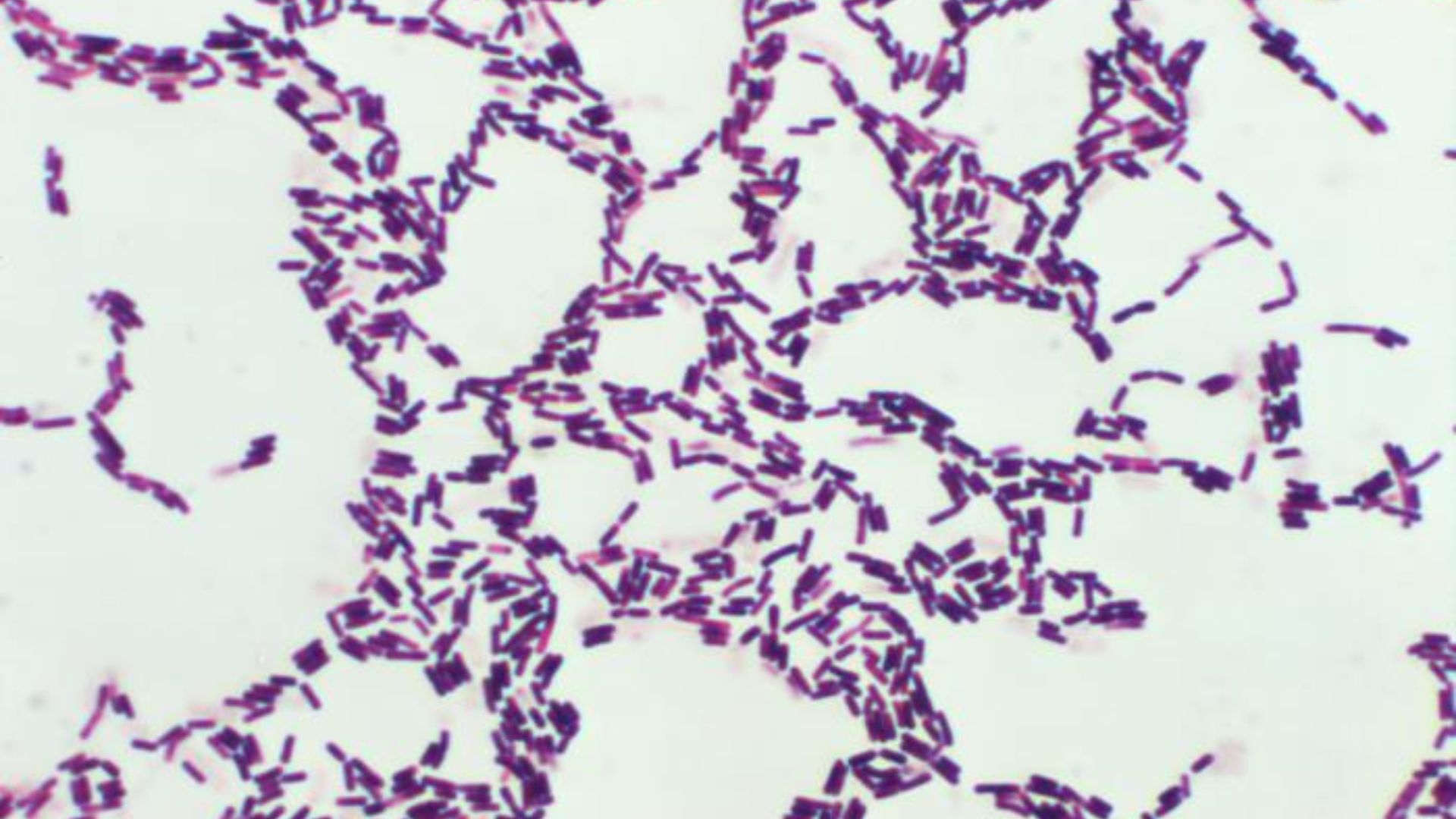 File:Bacillus coagulans 01.jpg