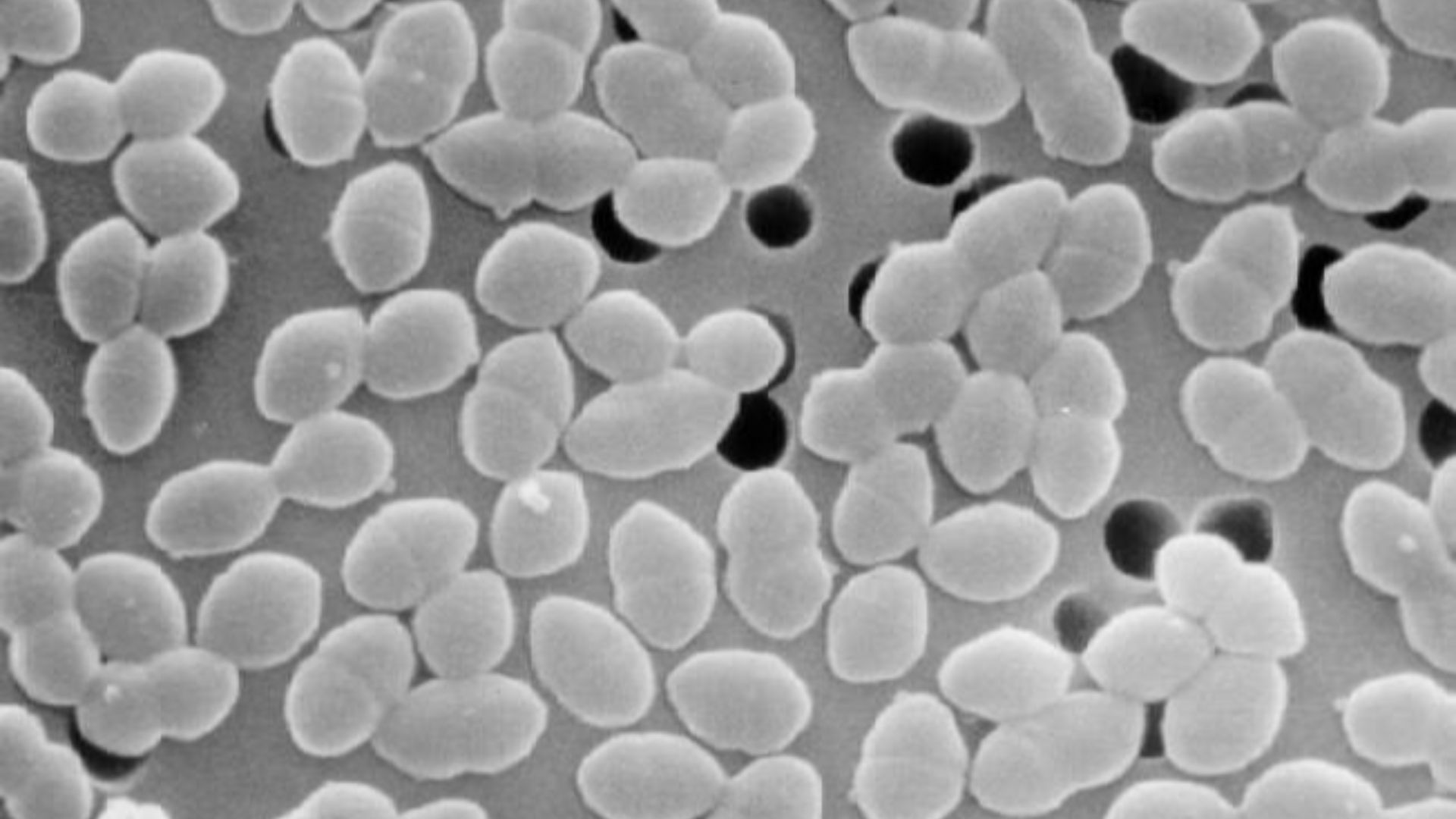 File:Entercoccus sp2 lores.jpg