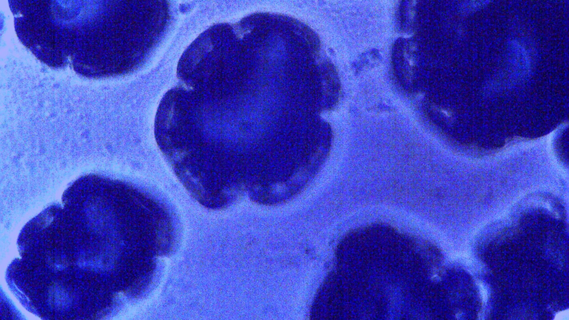 File:Mutans Streptococci colonies on Mitis Salivarius Agar.jpg