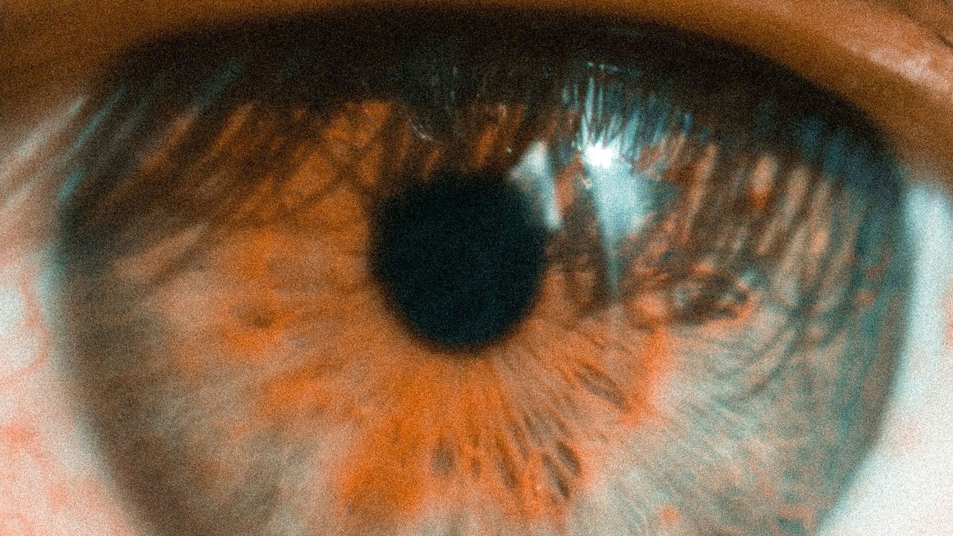 persons brown and black eye