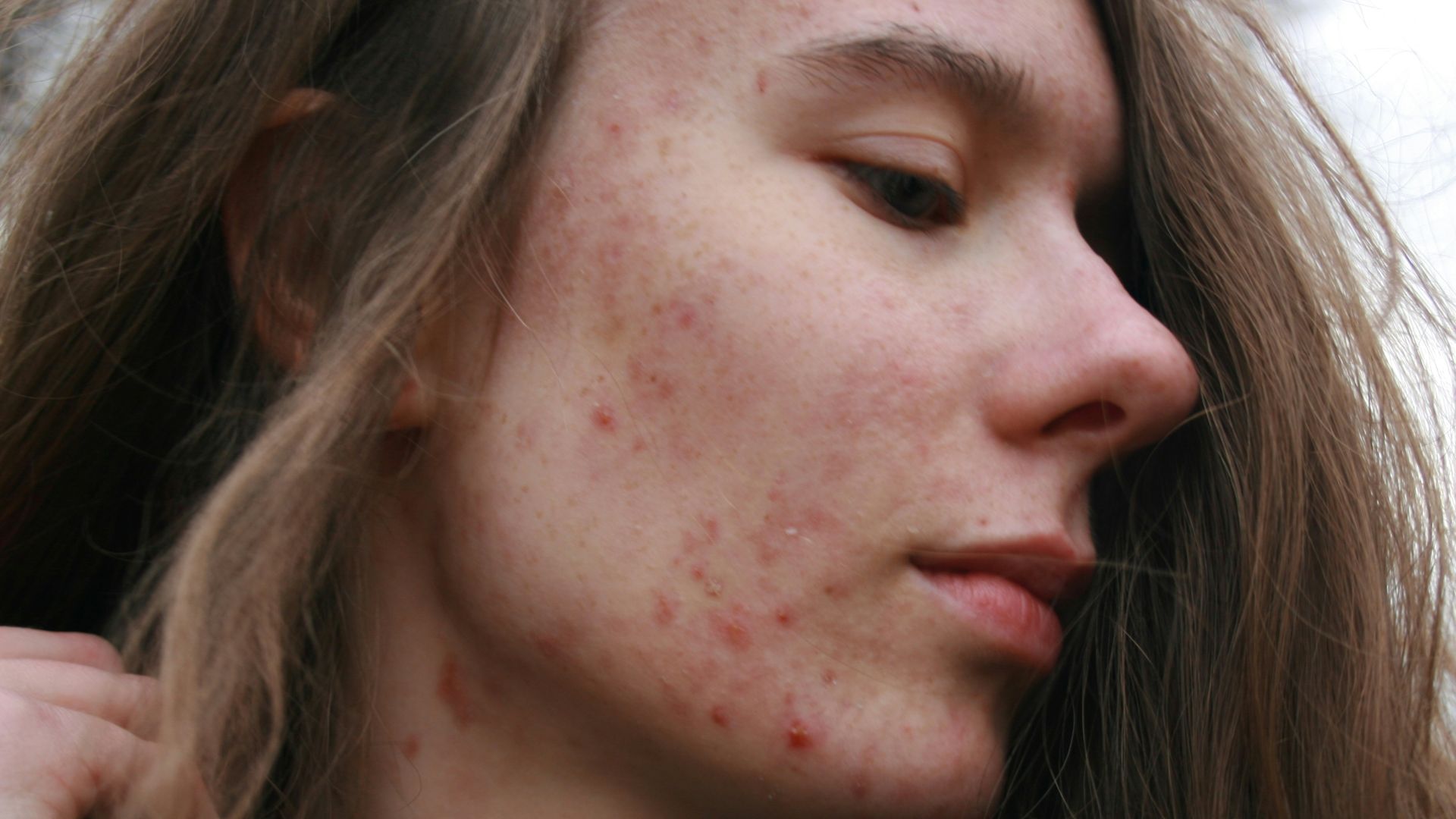 a woman with a substance on her face