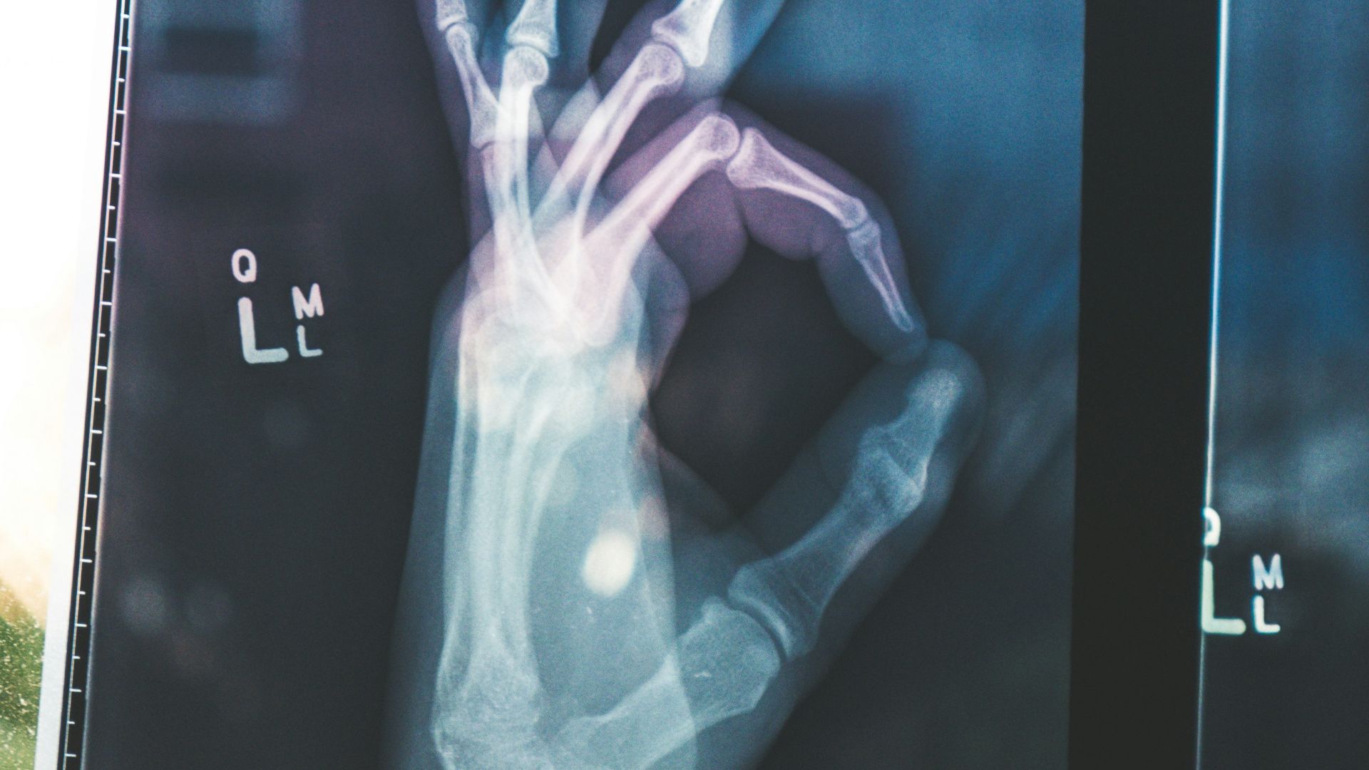 citiscan result hand ok