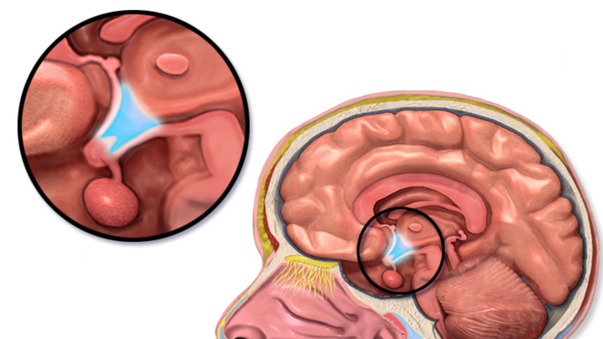 File:Blausen 0536 HypothalamusLocation.png