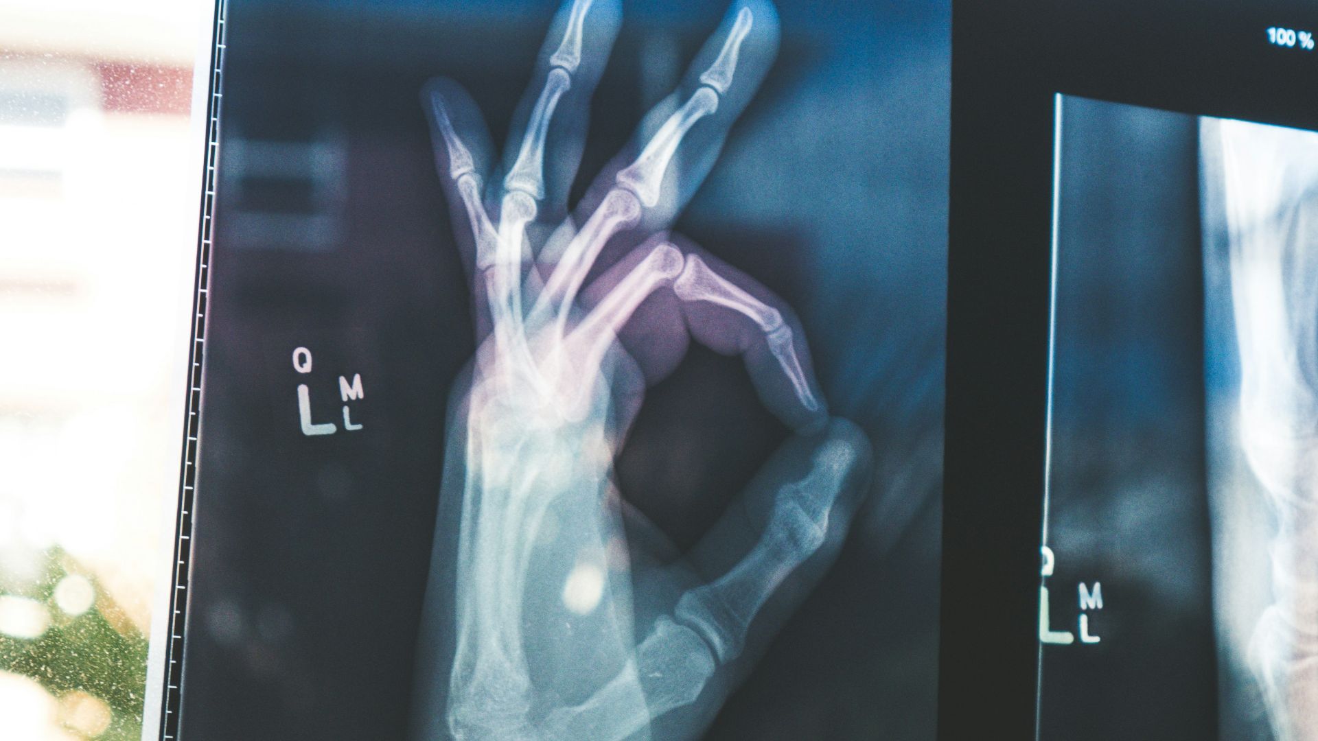 citiscan result hand ok