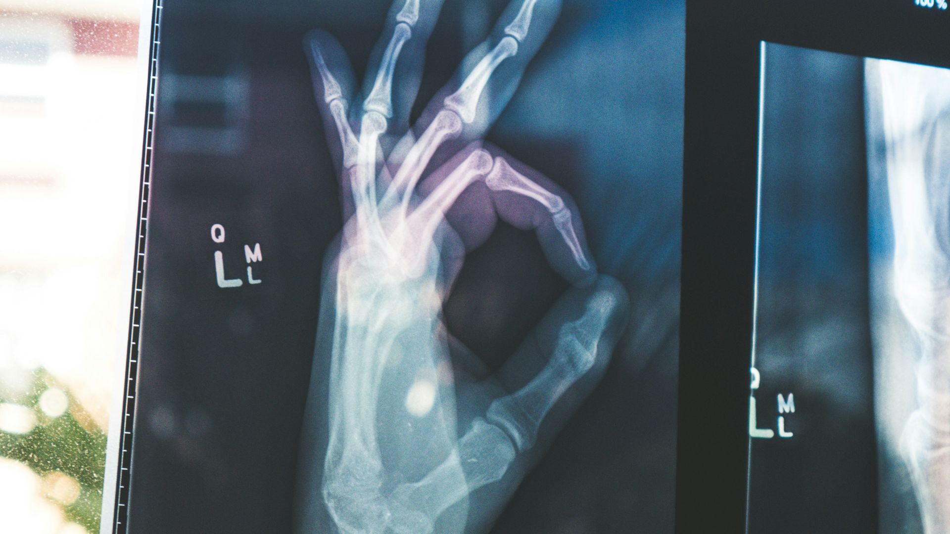 citiscan result hand ok