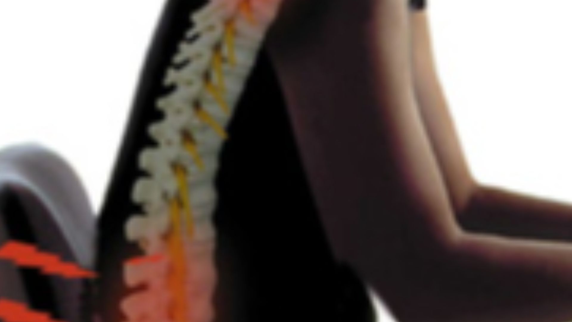 File:Bad posture.jpg