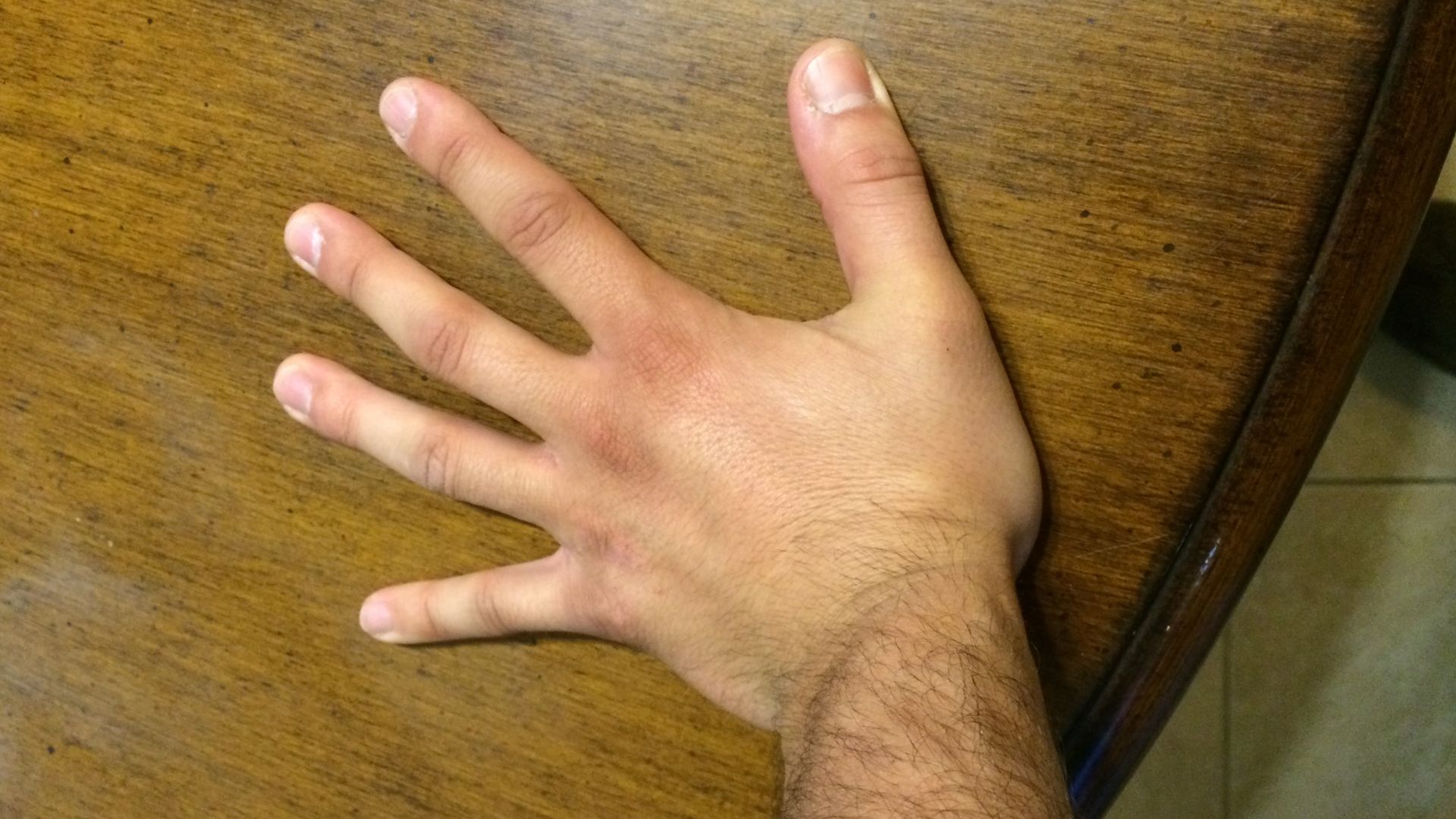 File:Carpal tunnel hand stretch.JPG