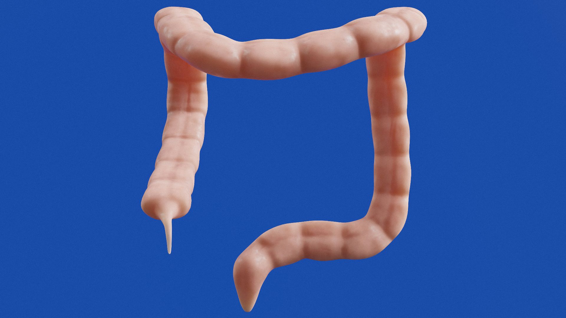 The image shows a 3D model of a colon.