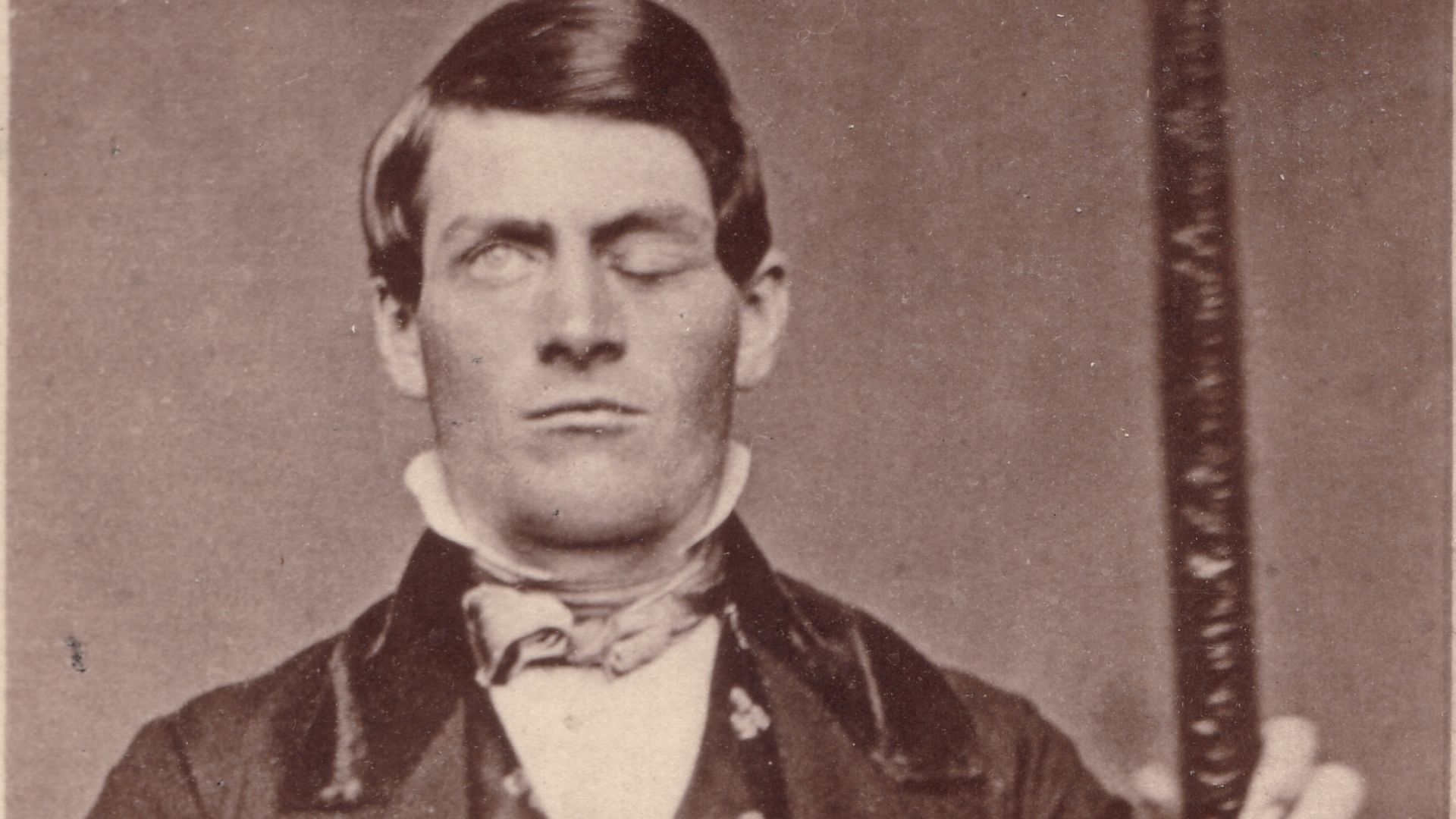File:Phineas Gage GageMillerPhoto2010-02-17 Unretouched Color Cropped.jpg