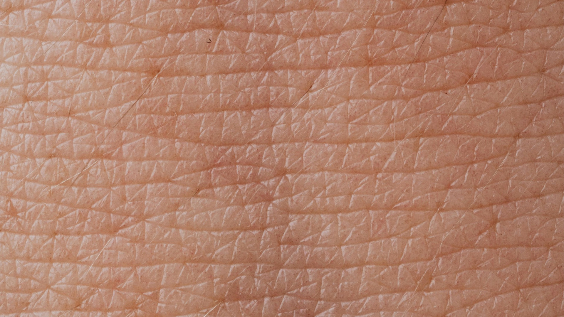 17775697066a1a438a6667bfe8086dde67be5f1b815fdfa21f.jpeg