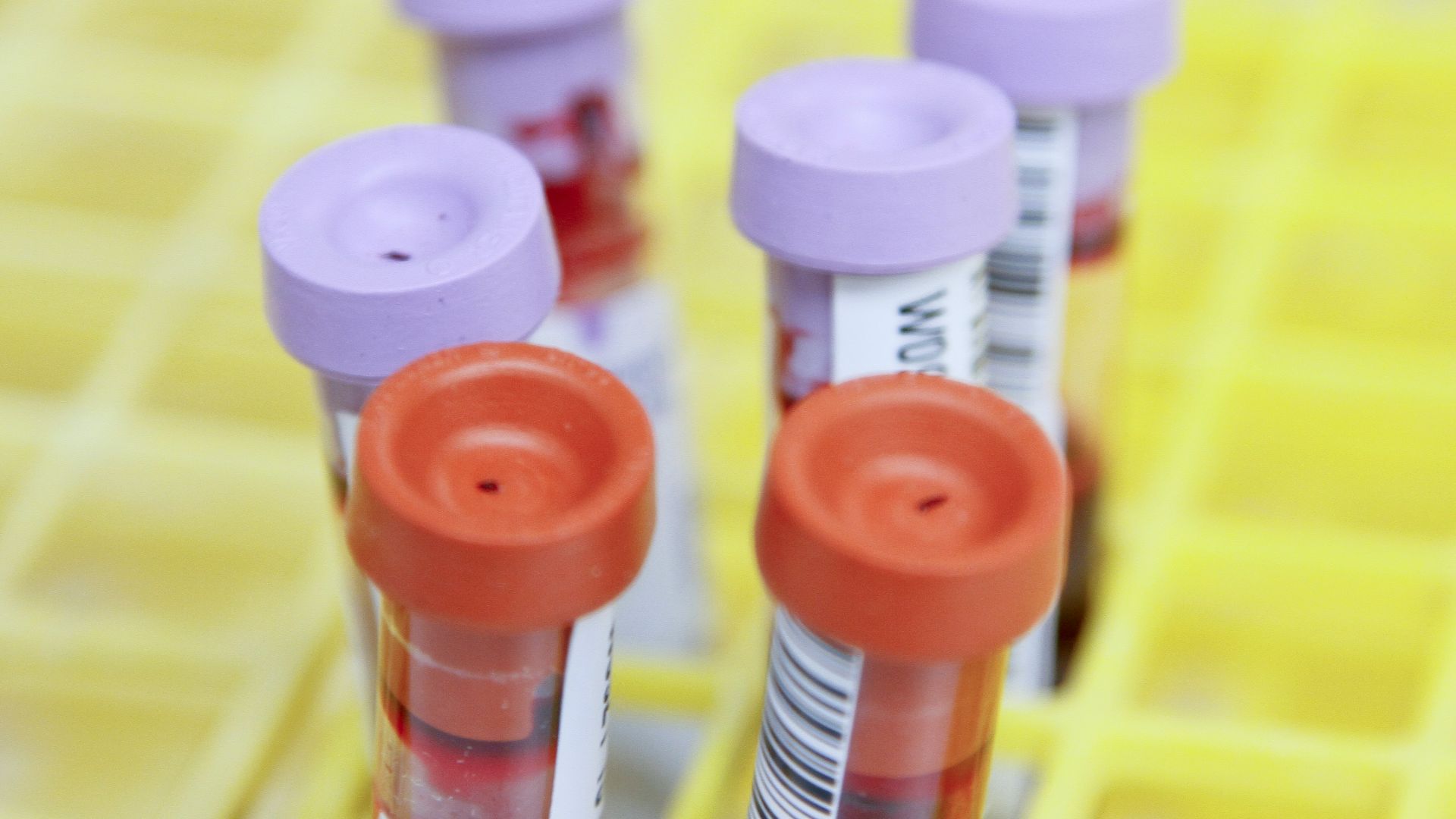 17792951413025799087e0f1f506e3ef3dec990dfacd1d0bfd.jpg