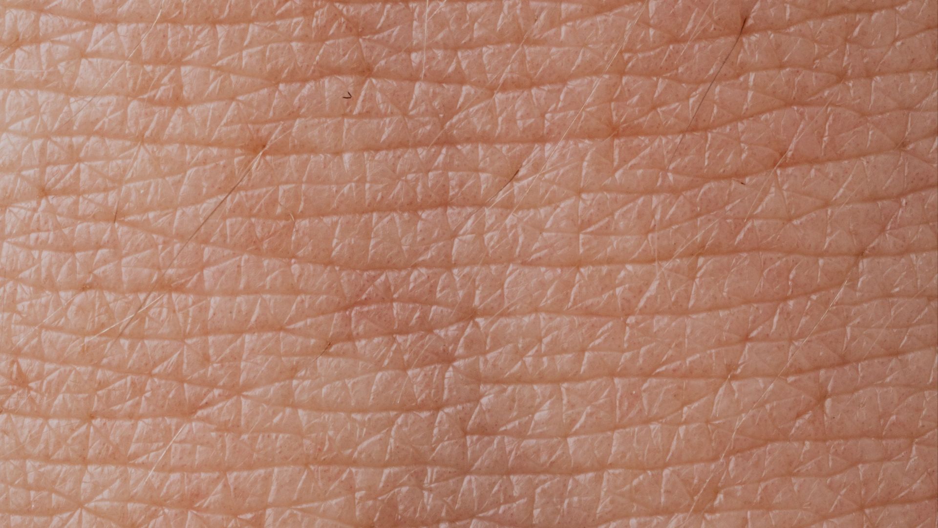 17884715366a1a438a6667bfe8086dde67be5f1b815fdfa21f.jpeg