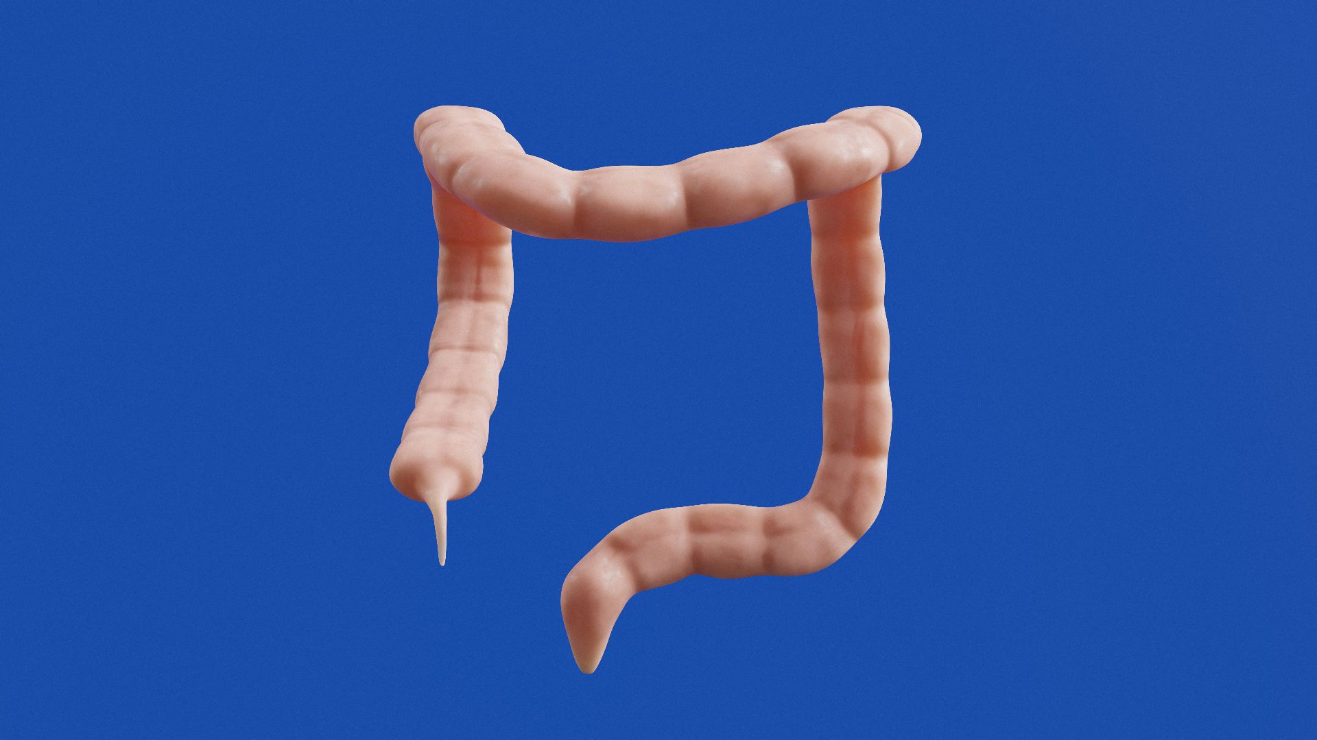 The image shows a 3D model of a colon.