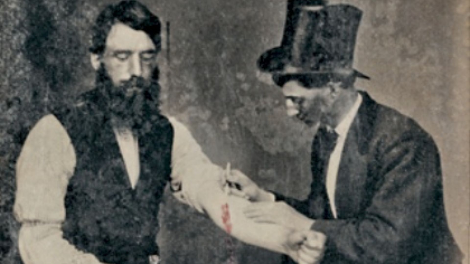 File:BloodlettingPhoto (cropped).jpg