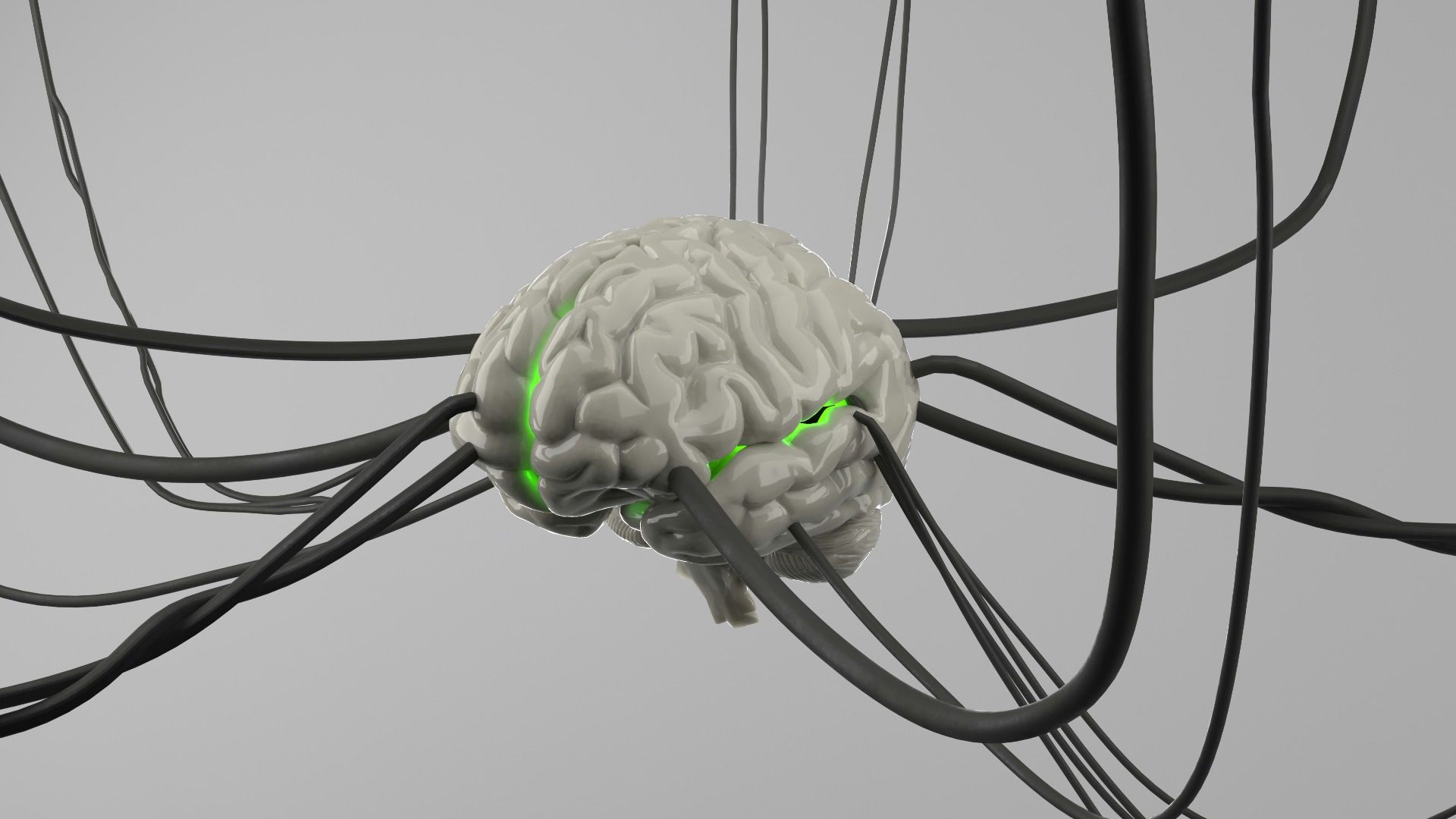 A computer generated image of a brain surrounded by wires