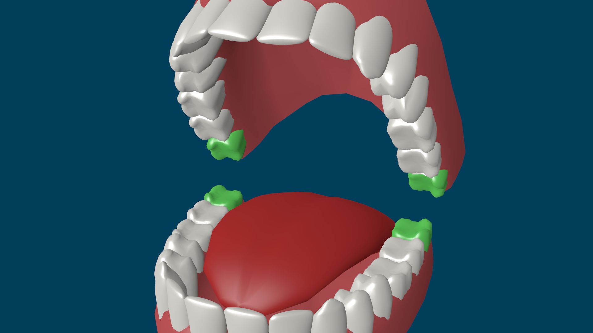 File:Зубы мудрости.png
