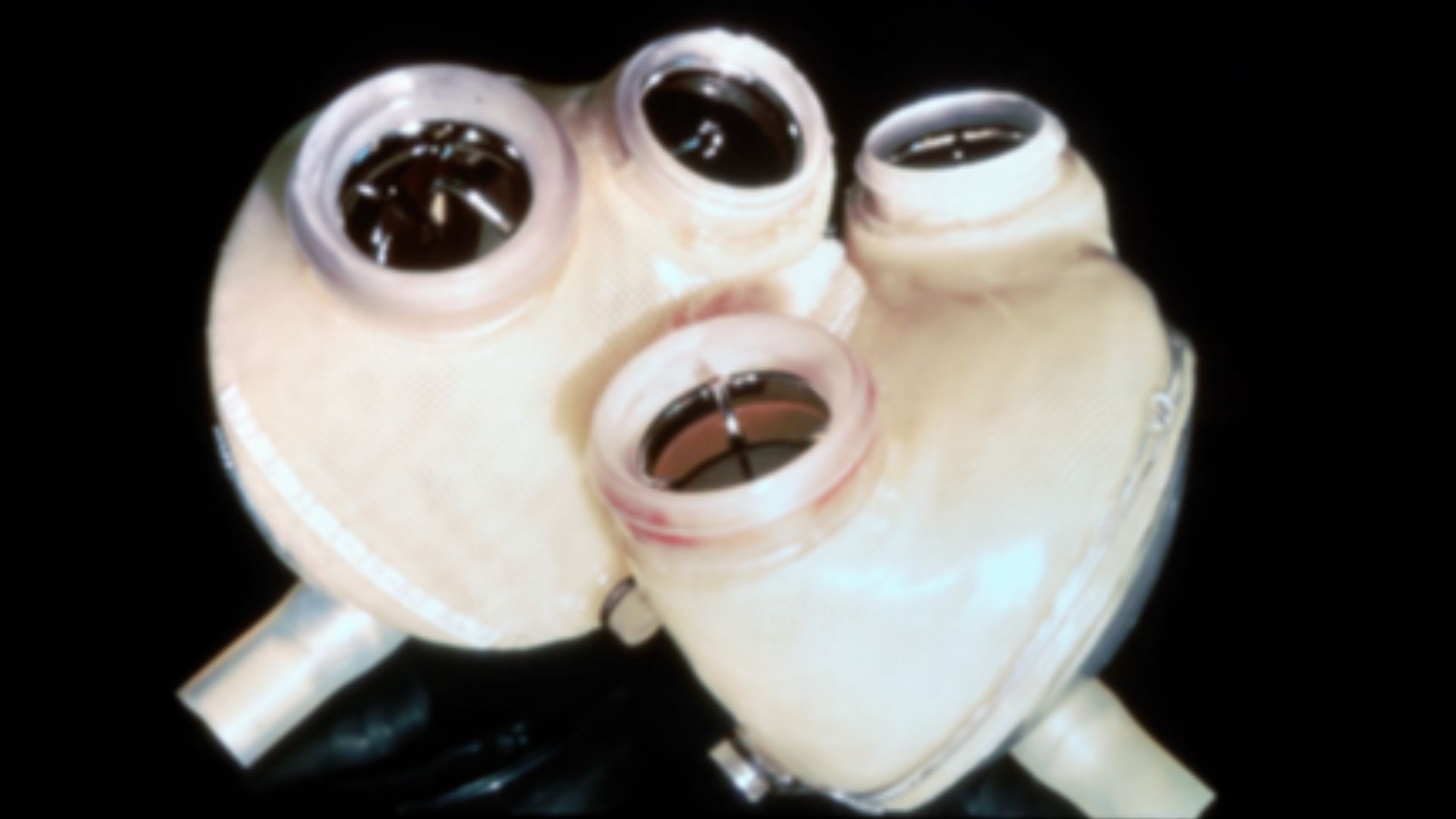 File:JARVIK 7 artificial heart.jpg