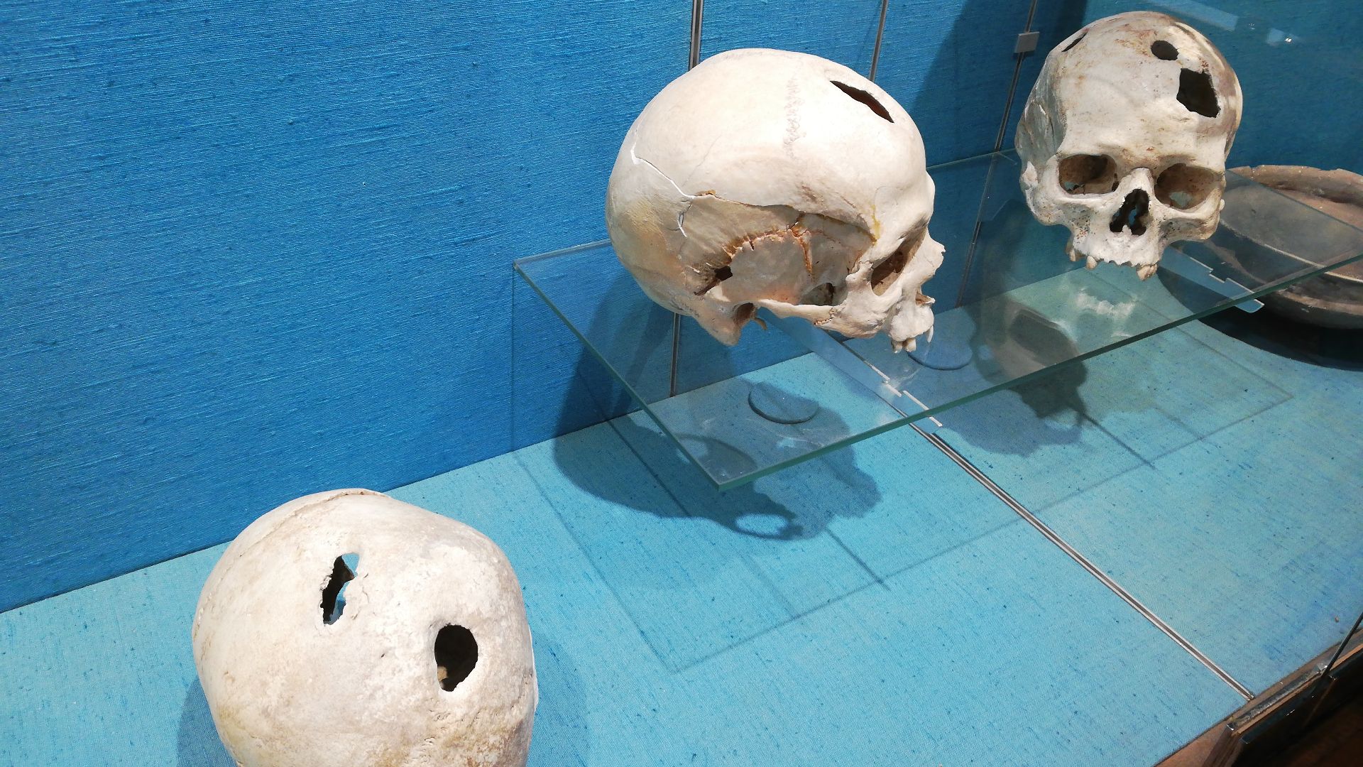 File:Crânes trépanation âge du bronze.jpg