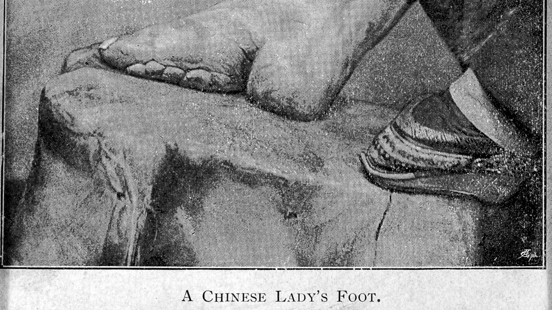 File:A Chinese lady's foot. Wellcome L0007510.jpg