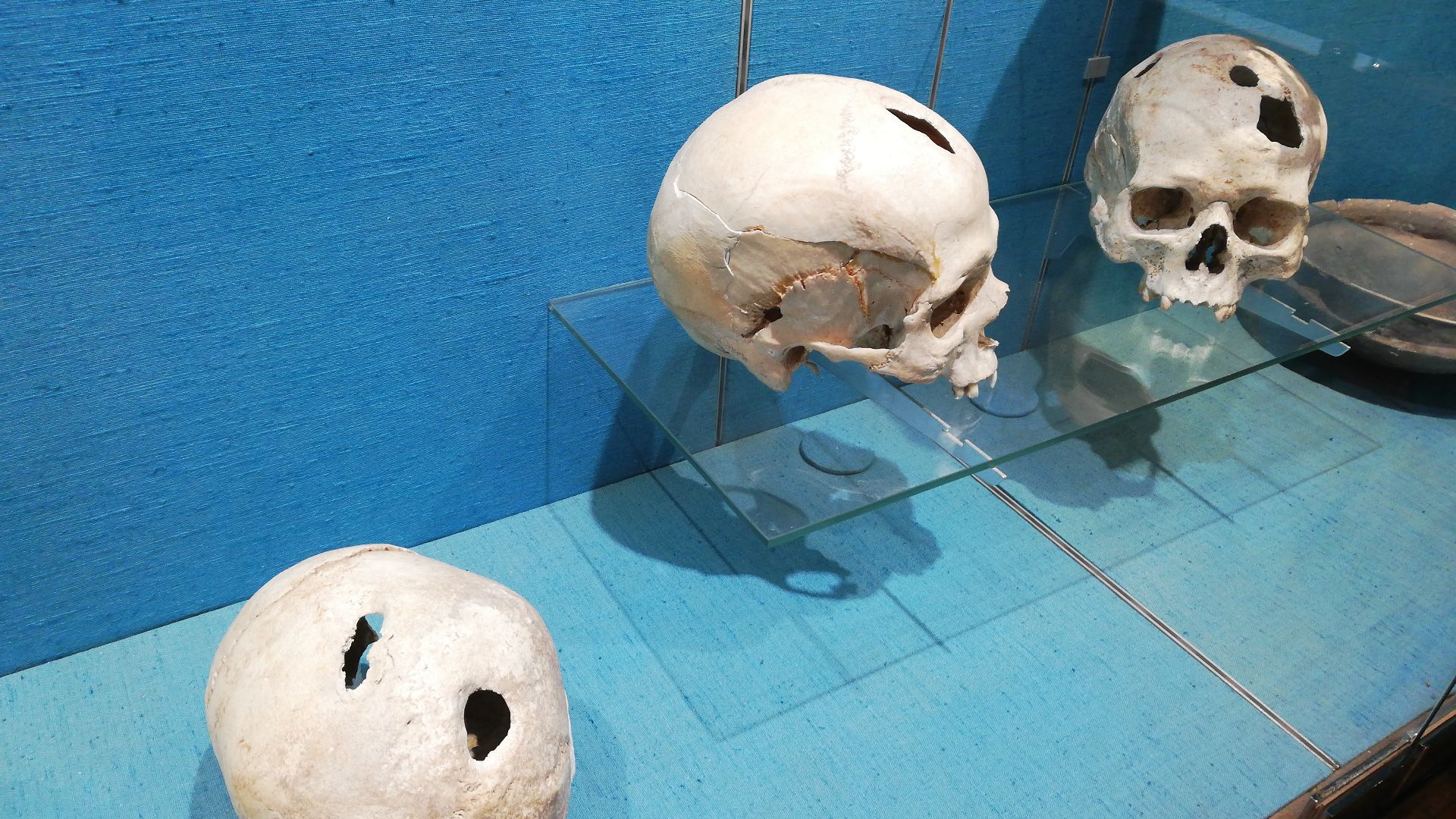 File:Crânes trépanation âge du bronze.jpg