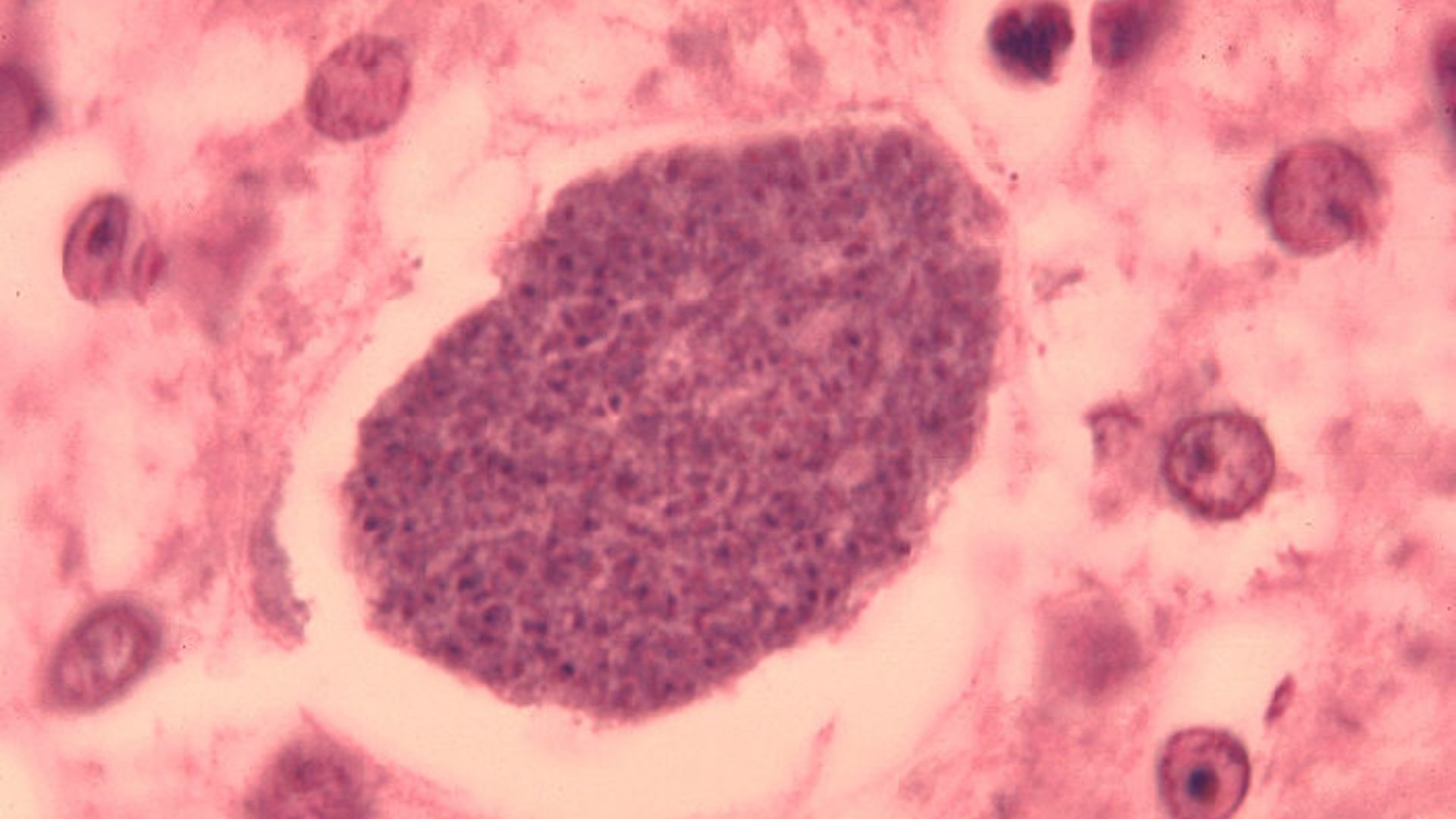 File:Histopathology of malaria exoerythrocytic forms in liver 07G0024 lores.jpg