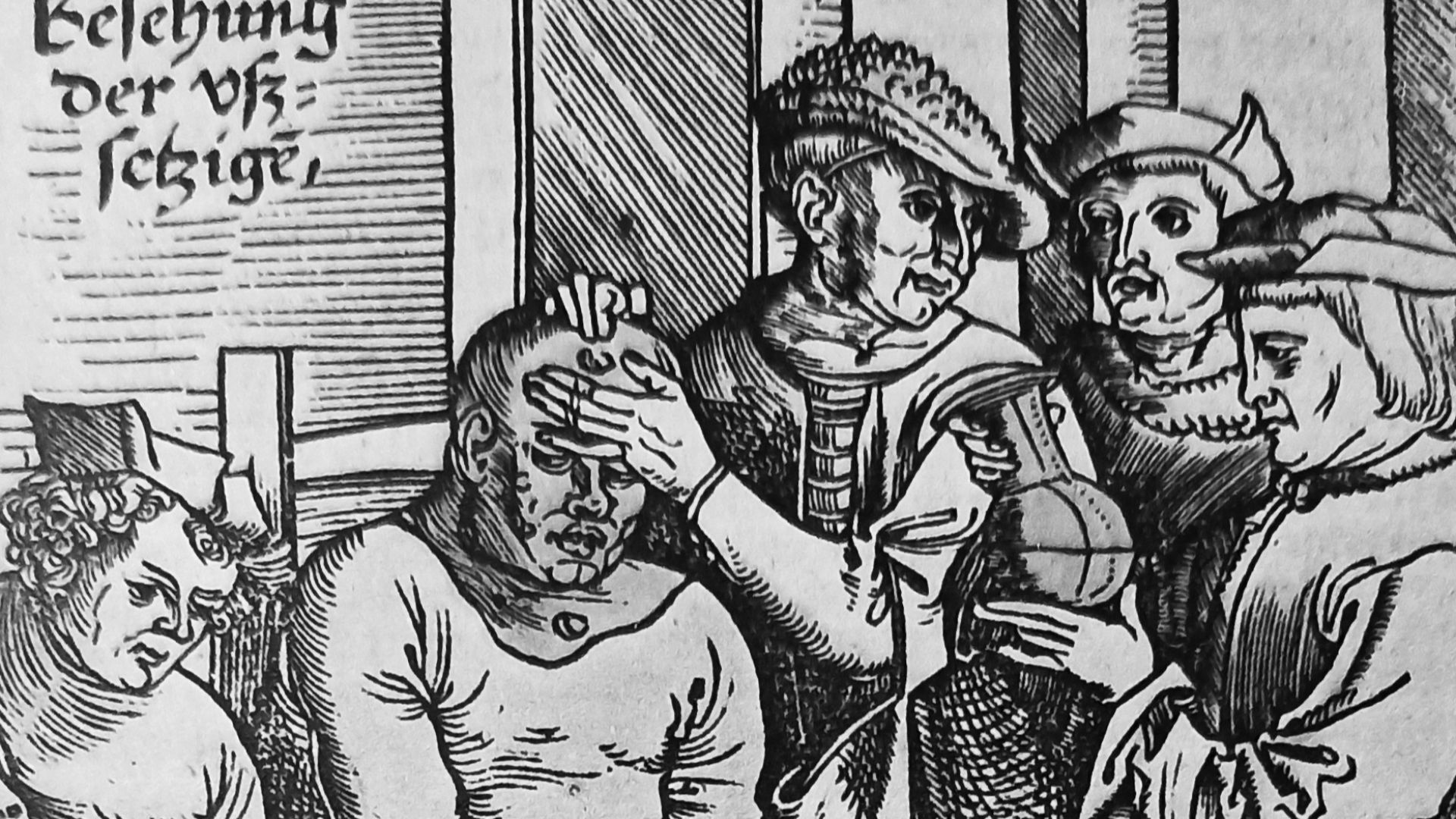 File:Leprosy diagnosis, 16th century.jpg