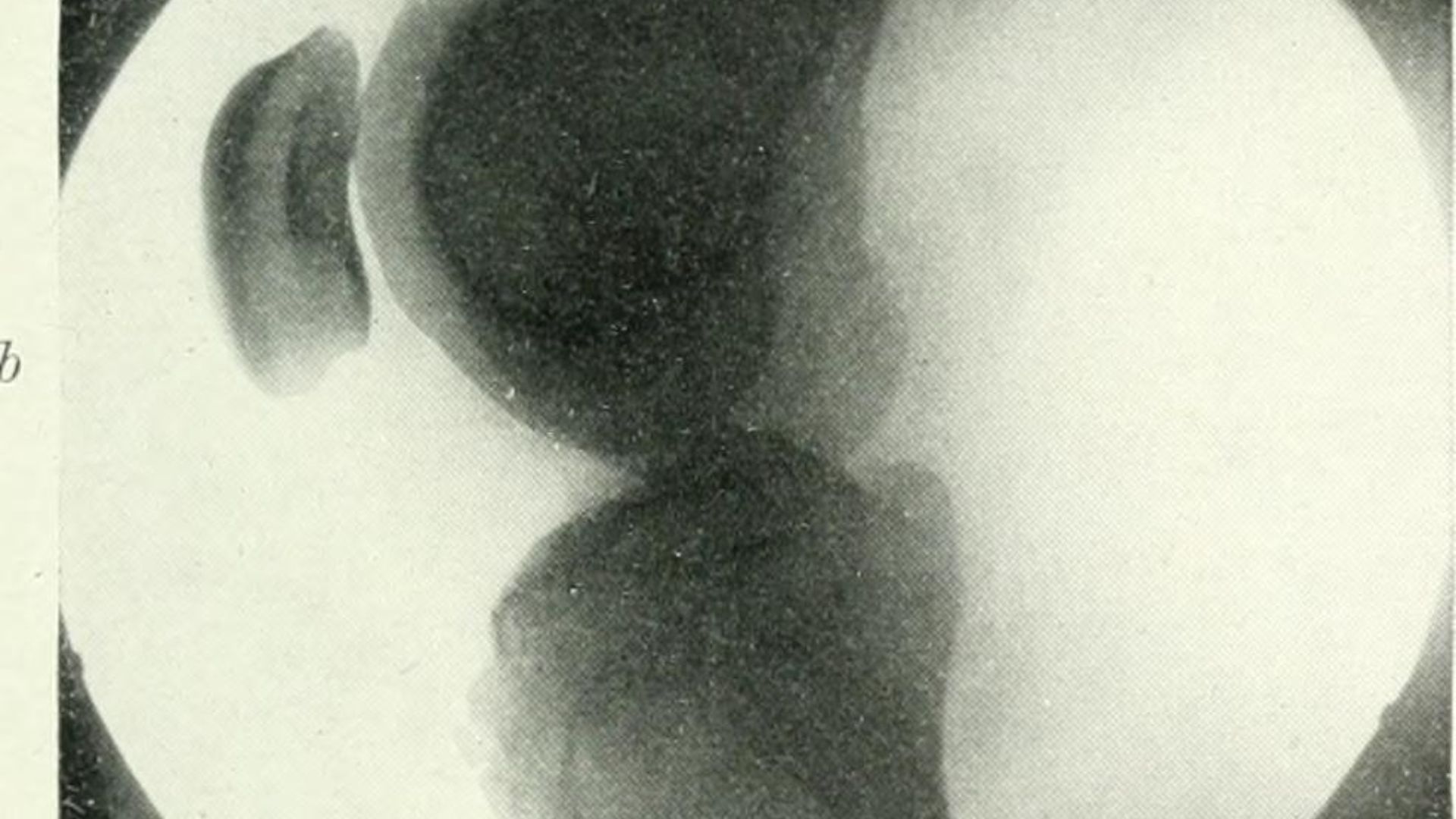 File:Radiography, x-ray therapeutics and radium therapy (1915) (14754399051).jpg