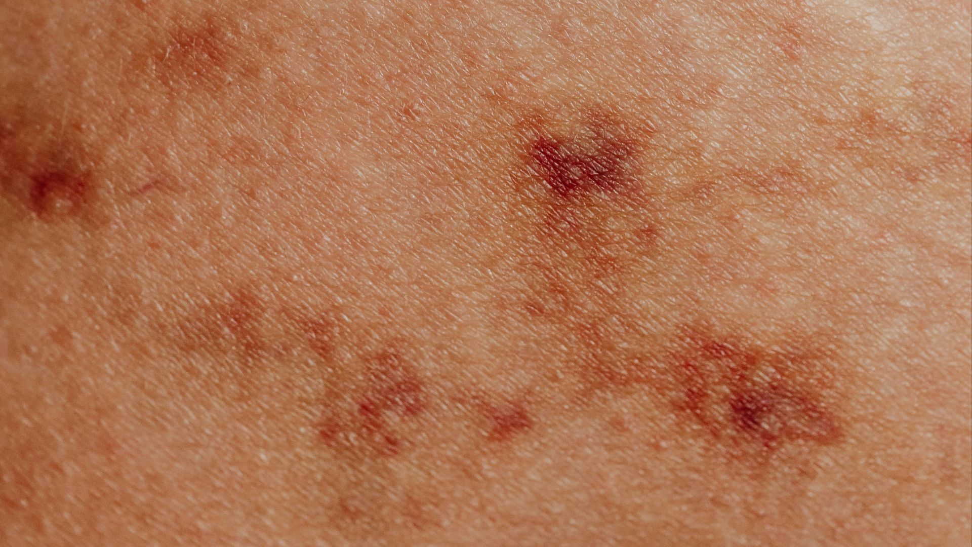 Photo By: Kaboompics.com