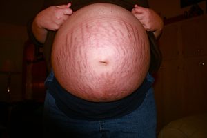 pregnant-1577212-300x200.jpg