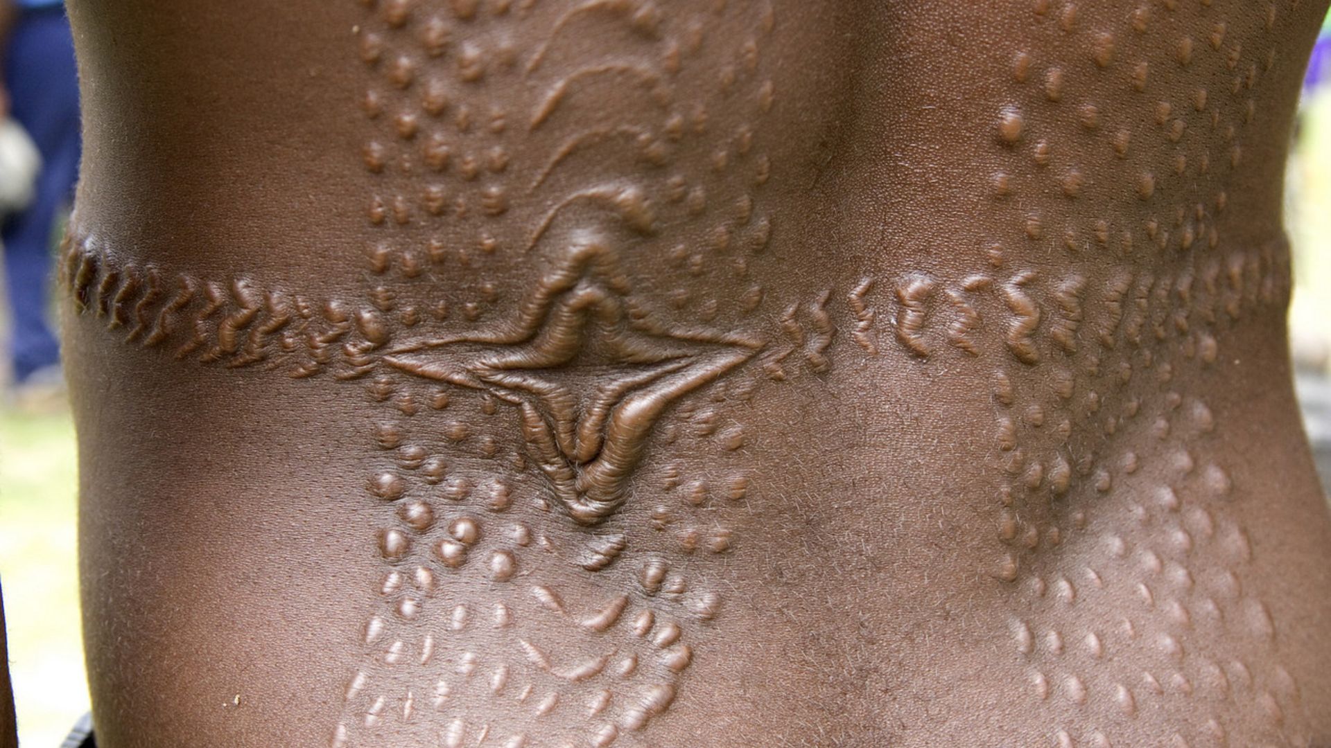 File:Tribal crocodile scarification, Sepik River, Papua New Guinea.jpg