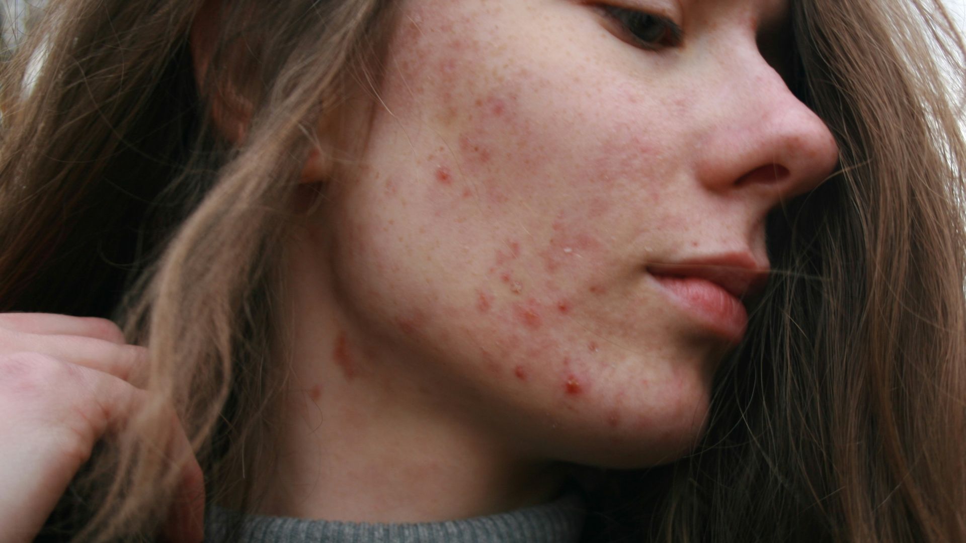 a woman with a substance on her face