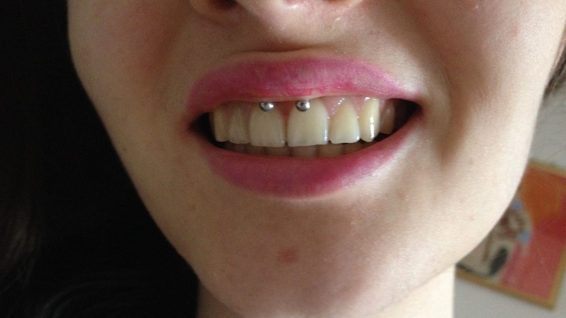 File:Piercing smiley.JPG