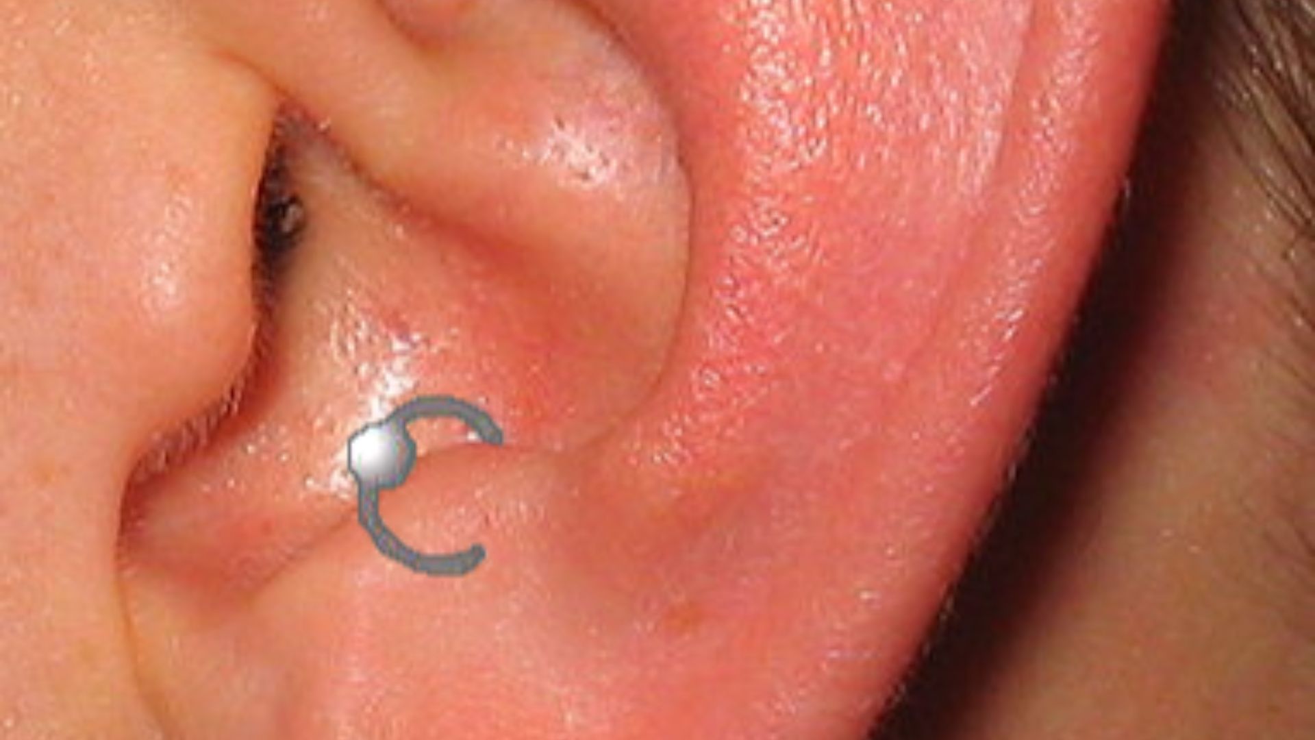 File:Antitragus.png