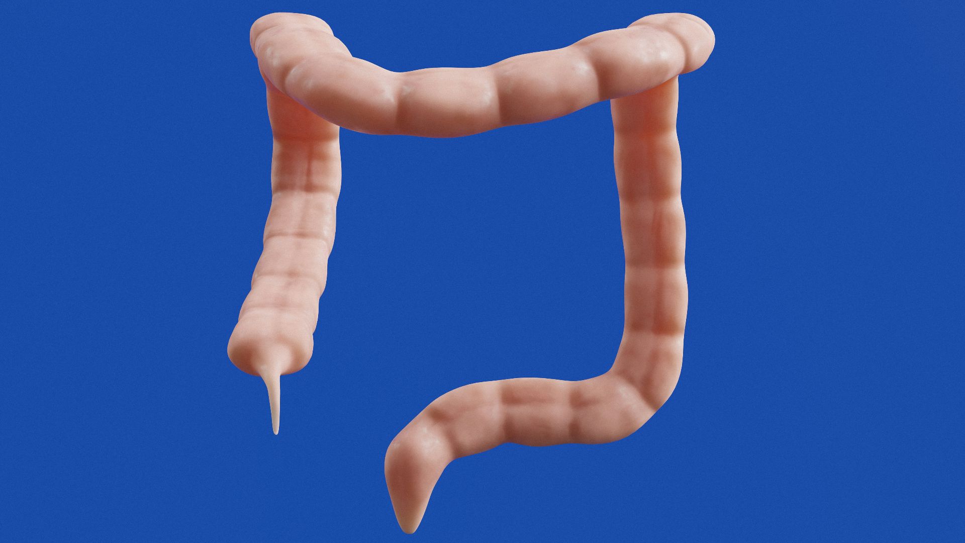 The image shows a 3D model of a colon.