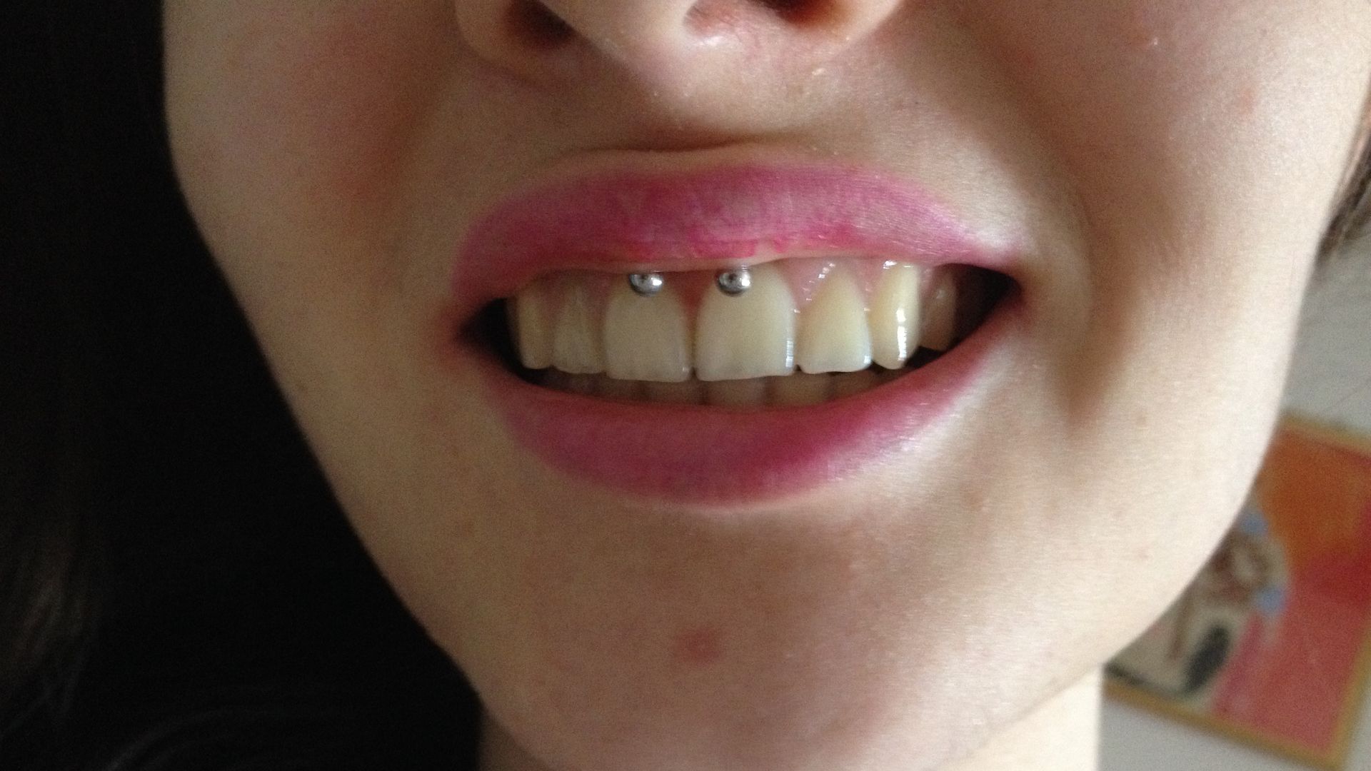 File:Piercing smiley.JPG