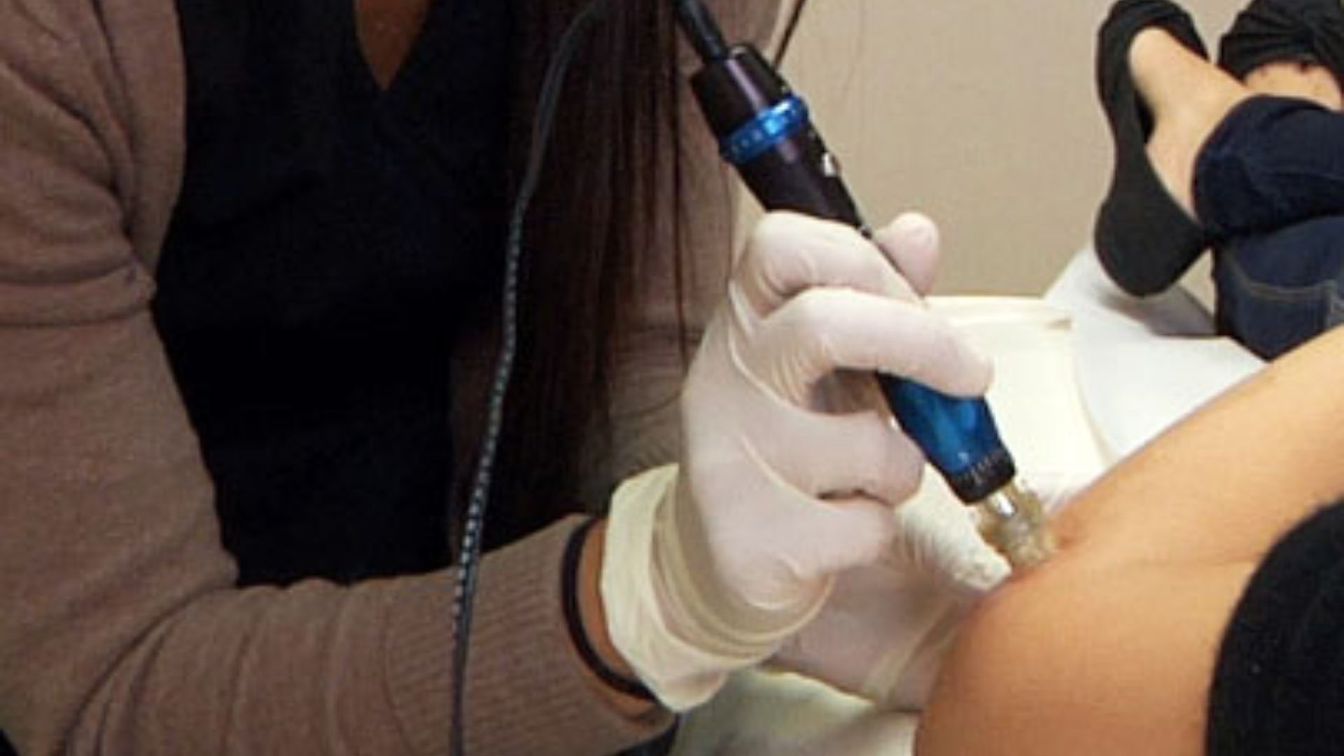 File:LVN Collagen Induction Therapy AMAskincare.jpg