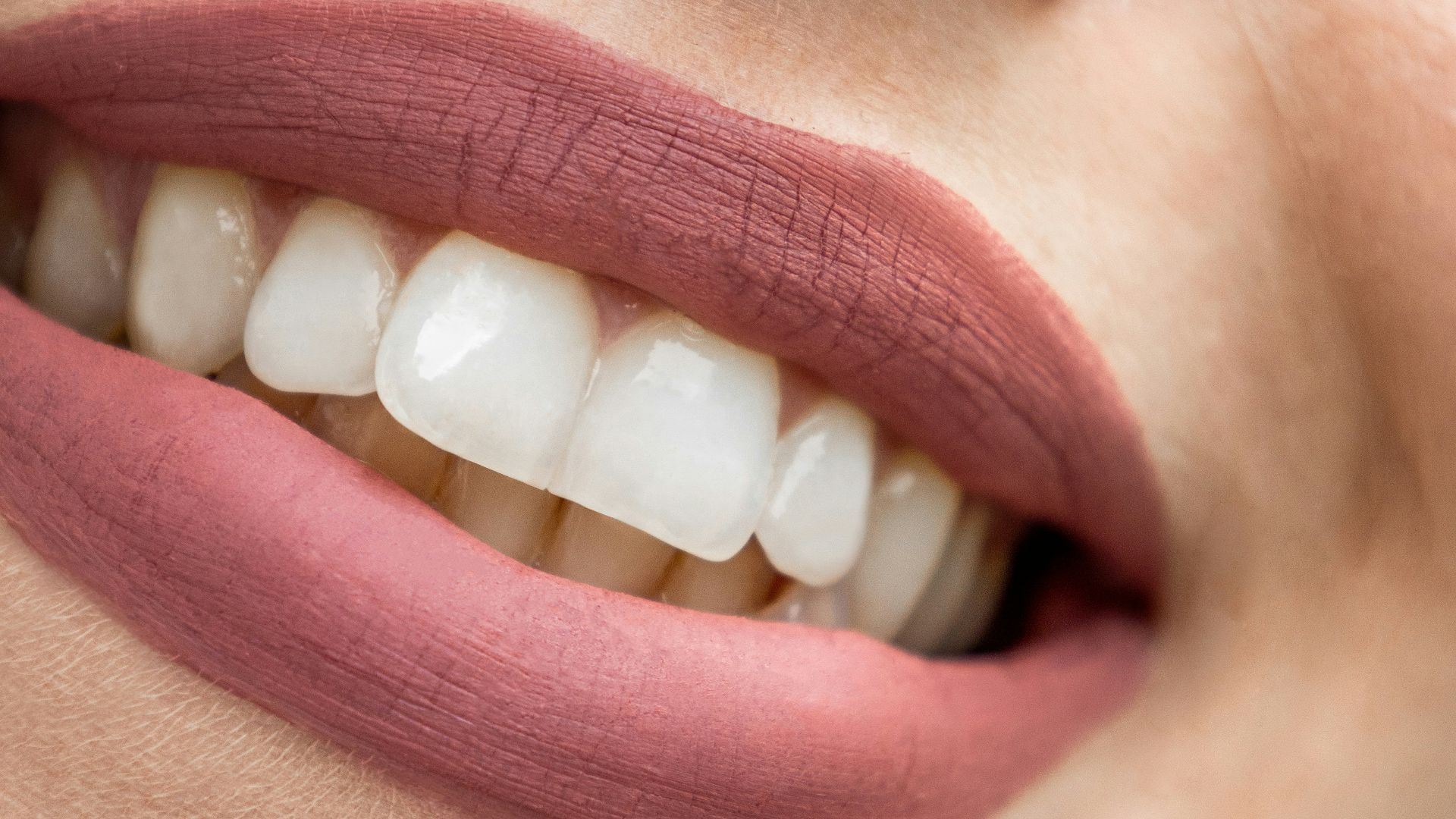 a close up of a woman's mouth with white teeth