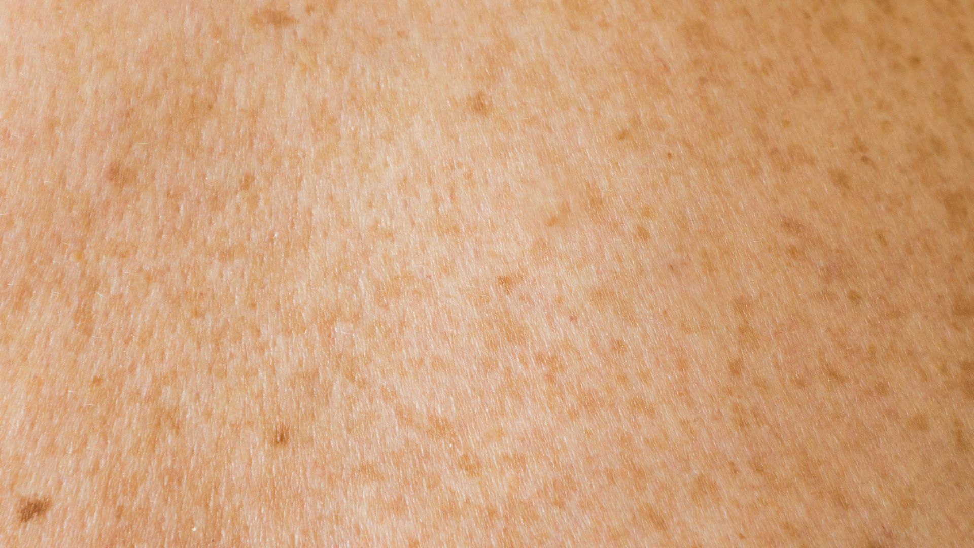 17811155486e1cf9184f50fd63d1f527ec3b0a363ec5c678c0.jpg