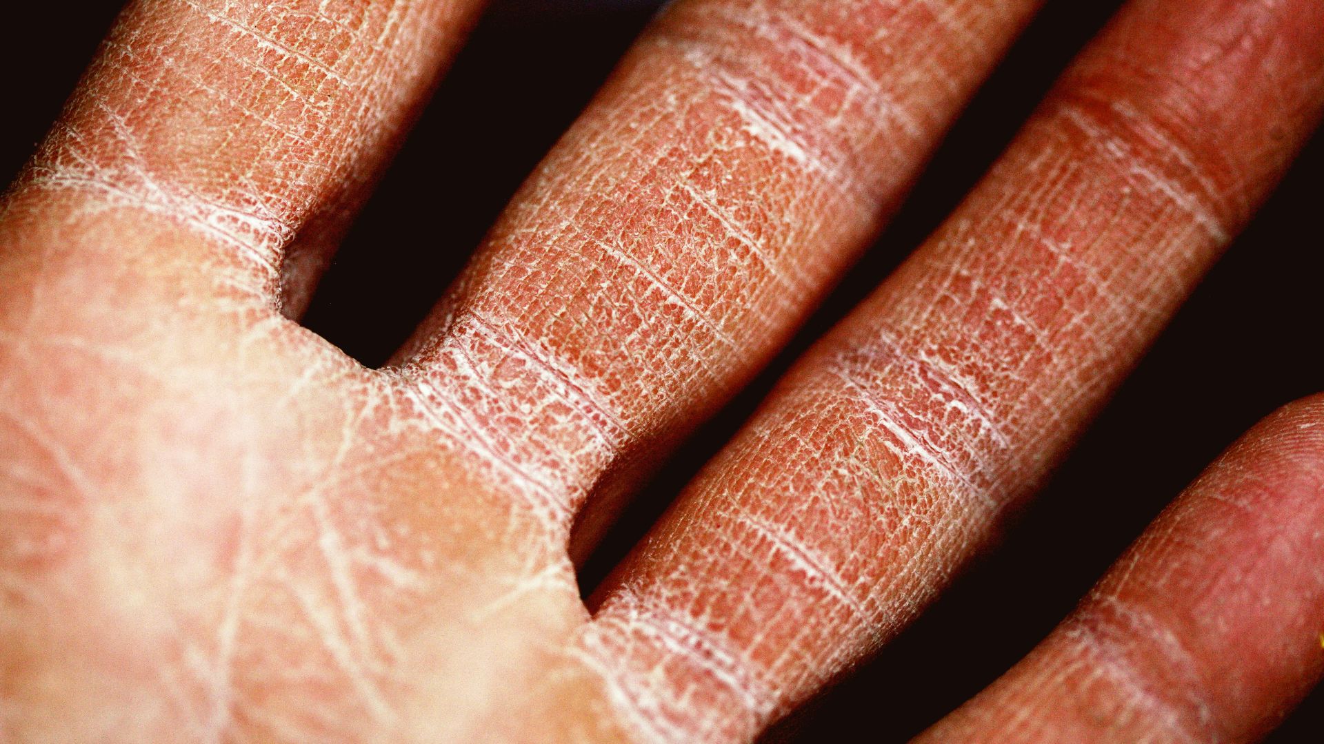 persons palm in close up photography
