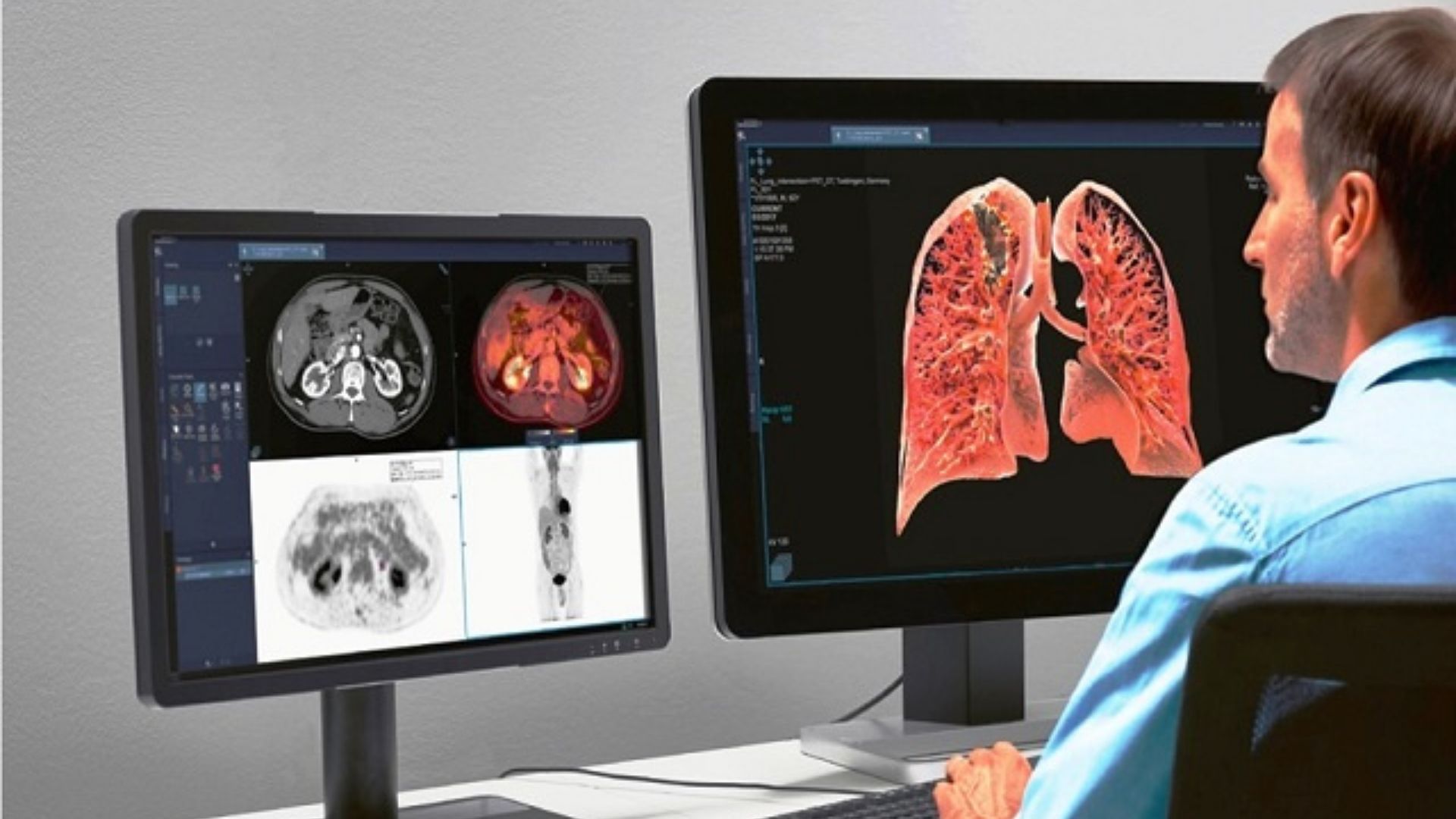 File:Radiologist working with modern IT system.jpg