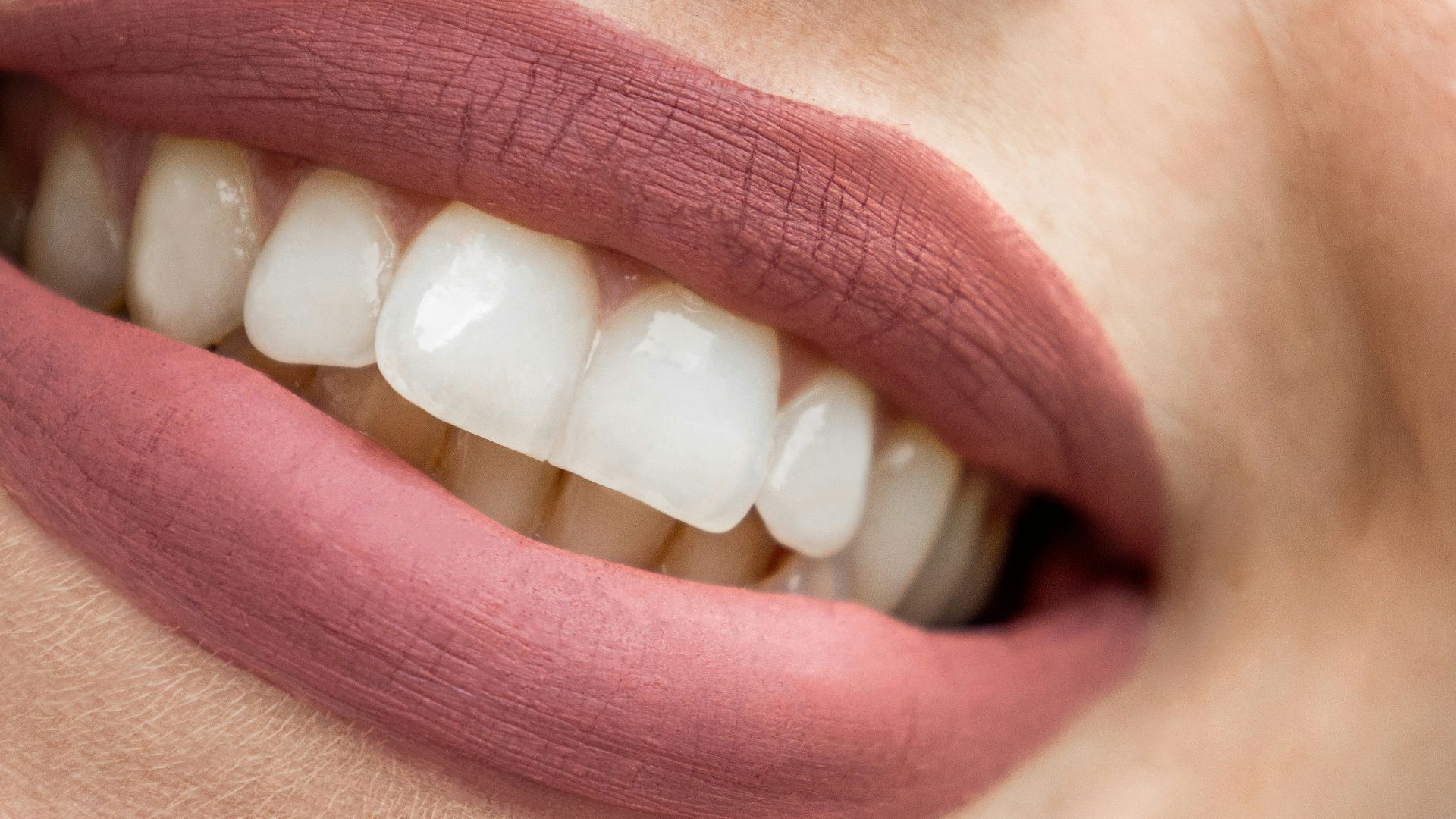 a close up of a woman's mouth with white teeth