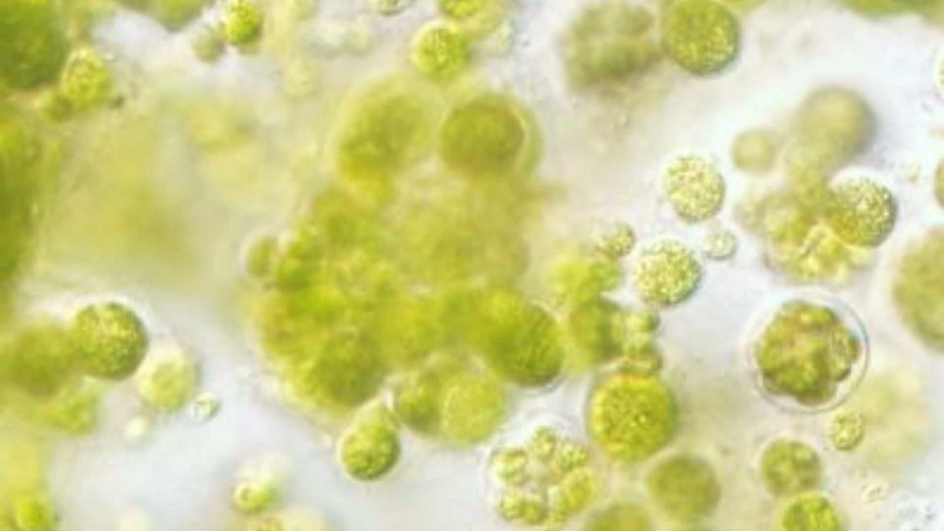 File:Chlorella with light microscopy.jpg