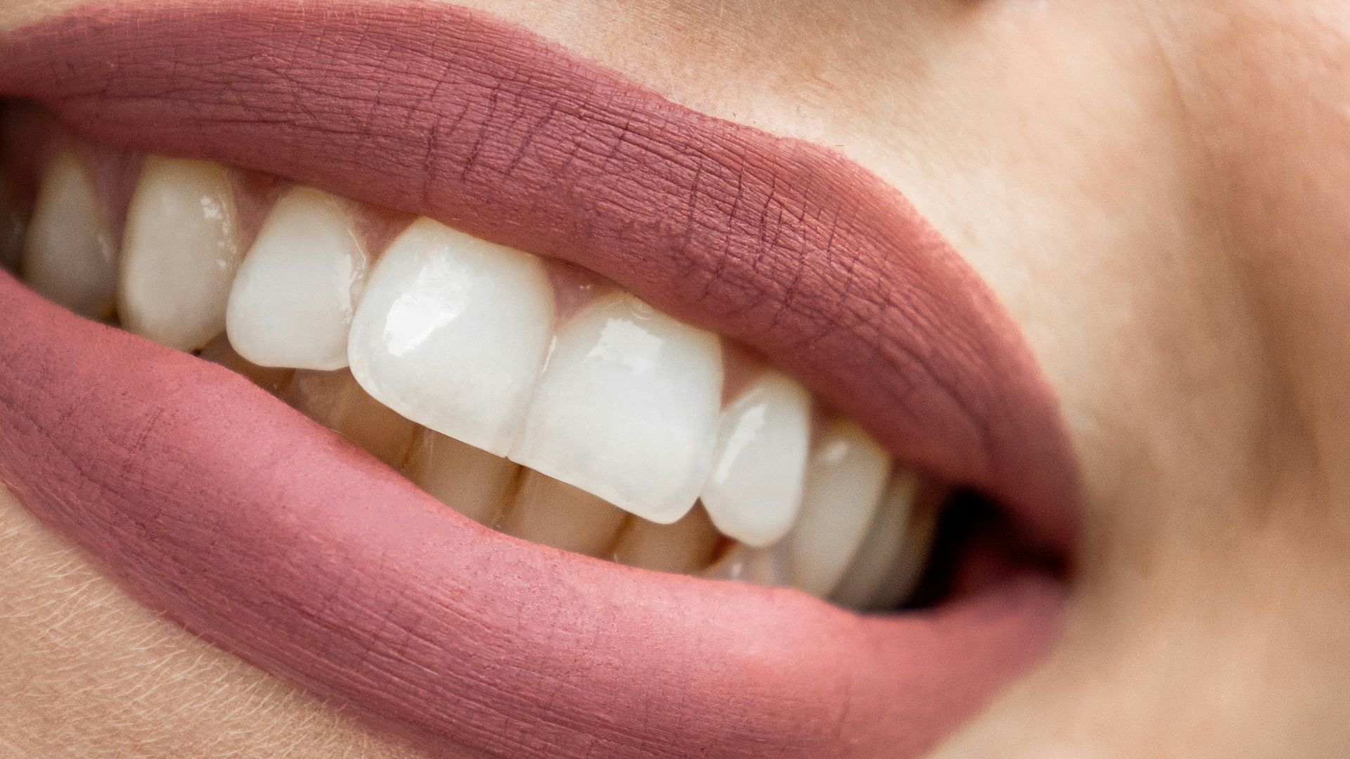 a close up of a woman's mouth with white teeth